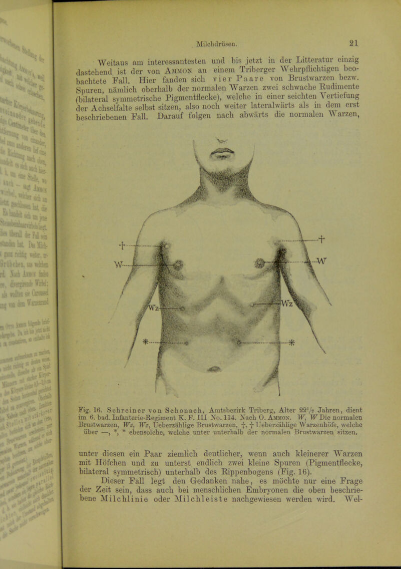 •: • |r 4 **, k',h «fernrn,, • *W L frÄ | wirk $ ^**>1 ■^^^laWnii^^Sert. ^ 'iberall 4« Fall m ■^Uiniltibat. Dutt, i iM richtig watet, m- i nibcheo, aus welchem ri .N irh hm Meo w, ihrerjireode Wirbel; i.s wlten sie Uroiissel ■ von dem War«inml „(Sr, 1)08 Mflri '■* A«rw-1 ‘rtitfte» OOlttURB. *>m . A_™ fl SlM l'jülW 11 t'', wiW . • '■ 1 •■.Stiel ■ „x. &ft «urw X : iVM V' , #r«r U»*1 ni1* iW > *:.** UP ?c ,. fü**,, *** f4t br**6, * ,■&«• r?-^röS : S^Vjeit^ i J'' ^ iw. '• '■ -t •'.•.>■£ AVeitaus am interessantesten und bis jetzt in der Litteratur einzig dastehend ist der von Ammon an einem Triberger Wehrpflichtigen beo- bachtete Fall. Hier fanden sich vier Paare von Brustwarzen bezw. Spuren, nämlich oberhalb der normalen Warzen zwei schwache Rudimente (bilateral symmetrische Pigmentflecke), welche in einer seichten A eitiefung der Achsel falte selbst sitzen, also noch weiter lateralwärts als in dem erst beschriebenen Fall. Darauf folgen nach abwärts die normalen W arzen, * ;T* & Fig. 16. Schreiner von Schonach, Amtsbezirk Triberg, Alter 221/* Jahren, dient im 6. had. Infanterie-Regiment K. F. III Xo. 114. Xach 0. Ammon. W, W Die normalen Brustwarzen, Wz, Wz, Ueberzählige Brustwarzen, 7. 7 Ueberzählige AVarzenhöfe, welche über —, *, * ebensolche, welche unter unterhalb der normalen Brustwarzen sitzen. unter diesen ein Paar ziemlich deutlicher, wenn auch kleinerer AY arzen mit Höfchen und zu unterst endlich zwei kleine Spuren (Pigmentflecke, bilateral symmetrisch) unterhalb des Rippenbogens (Fig. 16). Dieser Fall legt den Gedanken nahe, es möchte nur eine Frage der Zeit sein, dass auch bei menschlichen Embryonen die oben beschrie- bene Milchlinie oder Milchleiste nachgewiesen werden wird. AArel-