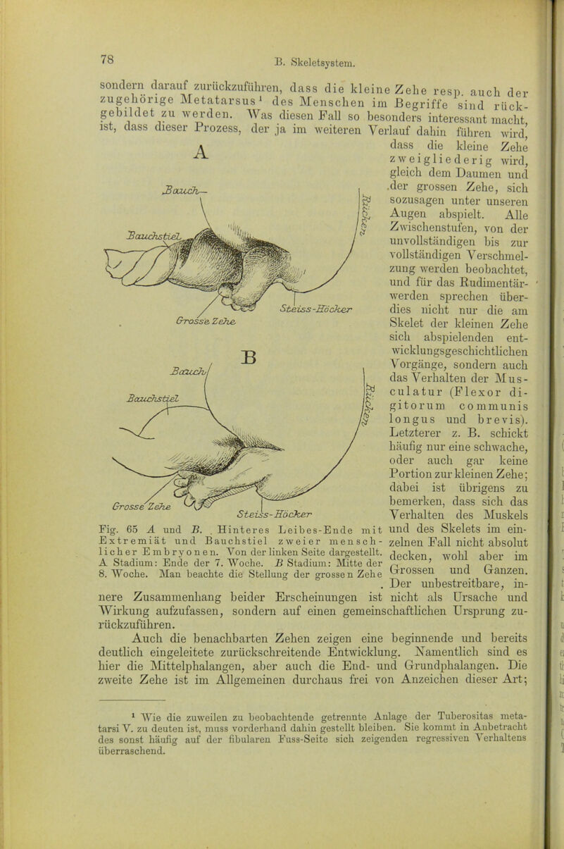 sondern darauf zurückzuführen, dass die kleine Zehe resp. auch der zugehörige Metatarsus1 des Menschen im .Begriffe sind rück- gebildet zu werden. Was diesen Fall so besonders interessant macht, ist, dass dieser Prozess, der ja im weiteren Verlauf dahin führen wird’ dass die kleine Zehe A zweigliederig wird, gleich dem Daumen und .der grossen Zehe, sich sozusagen unter unseren Augen abspielt. Alle Zwischenstufen, von der unvollständigen bis zur vollständigen Verschmel- zung werden beobachtet, und für das Rudimentär- werden sprechen über- dies nicht nur die am Skelet der kleinen Zehe sich abspielenden ent- wicklungsgeschichtlichen Vorgänge, sondern auch das Verhalten der Mus- culatur (Flexor di- g i t o r u m c o m m u n i s longus und brevis). Letzterer z. B. schickt häufig nur eine schwache, oder auch gar keine Portion zur kleinen Zehe; dabei ist übrigens zu bemerken, dass sich das Verhalten des Muskels und des Skelets im ein- zelnen Fall nicht absolut decken, wohl aber im Grossen und Ganzen. Der unbestreitbare, in- nere Zusammenhang beider Erscheinungen ist nicht als Ursache und Wirkung aufzufassen, sondern auf einen gemeinschaftlichen Ursprung zu- rückzuführen. Auch die benachbarten Zehen zeigen eine beginnende und bereits deutlich eingeleitete zurückschreitende Entwicklung. Namentlich sind es hier die Mittelphalangen, aber auch die End- und Grundphalangen. Die zweite Zehe ist im Allgemeinen durchaus frei von Anzeichen dieser Art; Fig. 65 A und B. . Hinteres Leibes-Ende mit Extremiät und Bauch stiel zweier mensch- licher Embryonen. Yon der linken Seite dargestellt. A Stadium: Ende der 7. Woche. B Stadium: Mitte der 8. Woche. Man beachte die Stellung der grossen Zehe o o 1 Wie die zuweilen zu beobachtende getrennte Anlage der Tuberositas meta- tarsi V. zu deuten ist, muss vorderhand dahin gestellt bleiben. Sie kommt in Anbetracht des sonst häufig auf der fibularen Fuss-Seite sich zeigenden regressiven A erhaltens überraschend.