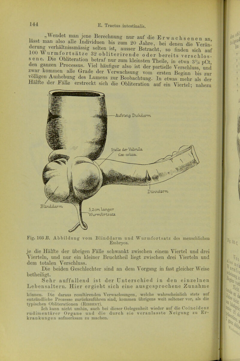 „Sendet man jene Berechnung nur auf die Erwachsenen an lasst man also alle Individuen bis zum 20 Jahre, bei denen die Verän- innUw verlu];ltnifm^sslg selten ist, ausser Betracht, so finden sich auf 100 Wurmfortsätze 32 obliterirende oder bereits verschlos- sene. Die Ubliteration betraf nur zum kleinsten Theile, in etwa ?>v<z nCt den ganzen Processus. Viel häufiger also ist der partielle Verschluss, und zwar kommen alle Grade der Verwachsung vom ersten Beginn bis zur ™U,lgen 1AllI !1e nUng deS Lumens zur Beobachtung. In etwas mehr als der Hallte der Falle erstreckt sich die Obliteration auf ein Viertel; nahezu Fig. 103 B. Abbildung vom Blinddarm und Wurmfortsatz des menschlichen Embryos. je die Hälfte der übrigen Fälle schwankt zwischen einem Viertel und drei Vierteln, und nur ein kleiner Bruchtlieil liegt zwischen drei Vierteln und dem totalen Verschluss. Hie beiden Geschlechter sind an dem Vorgang in fast gleicherweise betheiligt. Sehr auffallend ist der Unterschied in den einzelnen Lebensaltern. Hier ergiebt sich eine ausgesprochene Zunahme können. Die daraus resultirenden Verwachsungen, welche wahrscheinlich stets auf entzündliche Prozesse zurückzuführen sind, kommen übrigens weit seltener vor, als die typischen Obliterationen (Bibbert). Ich kann nicht umhin, auch bei dieser Gelegenheit wieder auf die Coincidenz rudimentärer Organe und die durch sie veranlnsste Neigung zu Er- krankungen aufmerksam zu machen.