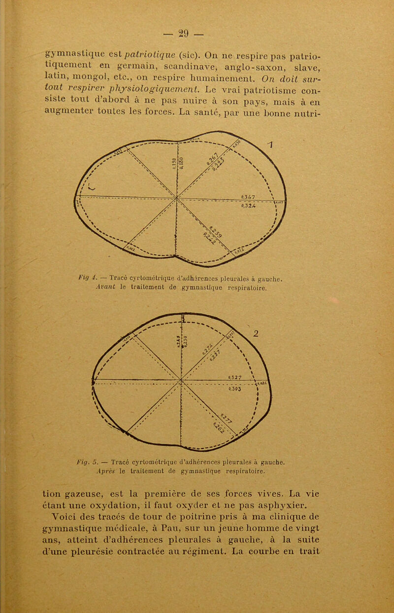 gymnastique est patriotique (sic). On ne respire pas patrio- tiquement en germain, Scandinave, anglo-saxon, slave, latin, mongol, etc., on respire humainement. On doit sur- tout respirer physiologiquement. Le vrai patriotisme con- siste tout d’abord à ne pas nuire à son pays, mais à en augmenter toutes les forces. La santé, par une bonne nutri- Fig 4. — Tracé cyrtométrique d’adhérences pleurales à gauche. Avant le traitement de gymnastique respiratoire. Fig. 5. — Tracé cyrtométrique d’adhérences pleurales à gauche. Après le traitement de gymnastique respiratoire. lion gazeuse, est la première de ses forces vives. La vie étant une oxydation, il faut oxyder et ne pas asphyxier. Voici des tracés de tour de poitrine pris à ma clinique de gymnastique médicale, à Pau, sur un jeune homme de vingt ans, atteint d’adhérences pleurales à gauche, à la suite d’une pleurésie contractée au régiment. La courbe en trait