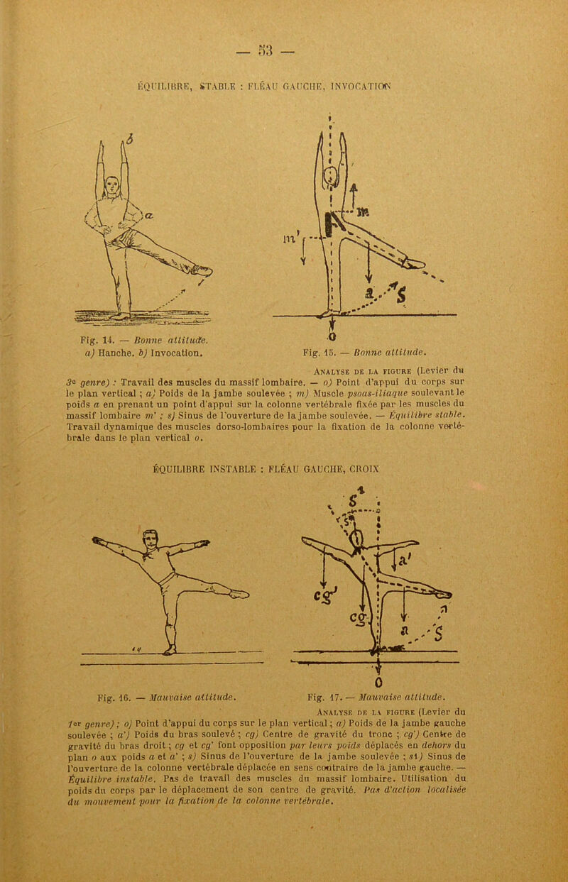 o3 — ÉQUILIBRE, STABLE : FLÉAU GAUCHE, INVOCATION Fig. IL — Bonne attitude, a) HaDche. b) Invocation. » » Analyse de la figure (Levier du 3° genre) : Travail des muscles du massif lombaire. — o) Point d’appui du corps sur le plan vertical ; a) Poids de la jambe soulevée ; m) Muscle psoas-iliaque soulevant le poids a en prenant un point d'appui sur la colonne vertébrale fixée par les muscles du massif lombaire m’ ; s) Sinus de l’ouverture de la jambe soulevée. — Équilibre stable. Travail dynamique des muscles dorso-lombaires pour la fixation de la colonne verté- brale dans le plan vertical o. ÉQUILIBRE INSTABLE : FLÉAU GAUCHE, CROIX Fig. tfi. — Mauvaise attitude. Fig. 17. — Mauvaise attitude. Analyse de la figure (Levier du 1er genre) ; o) Point d’appui du corps sur le plan vertical ; a) Poids de la jambe gauche soulevée ; a’) Poids du bras soulevé ; cg) Centre de gravité du tronc ; cg') Centre de gravité du bras droit ; cg et cg’ font opposition par leurs poids déplacés en dehors du plan o aux poids a et a' ; s) Sinus de l’ouverture de la jambe soulevée ; slj Sinus de l’ouverture de la colonne vertébrale déplacée en sens contraire do la jambe gauche. — Équilibre instable. Pas de travail des muscles du massif lombaire. Utilisation du poids du corps par le déplacement de son centre de gravité. Bas d’action localisée du mouvement pour la fixation de la colonne vertébrale.