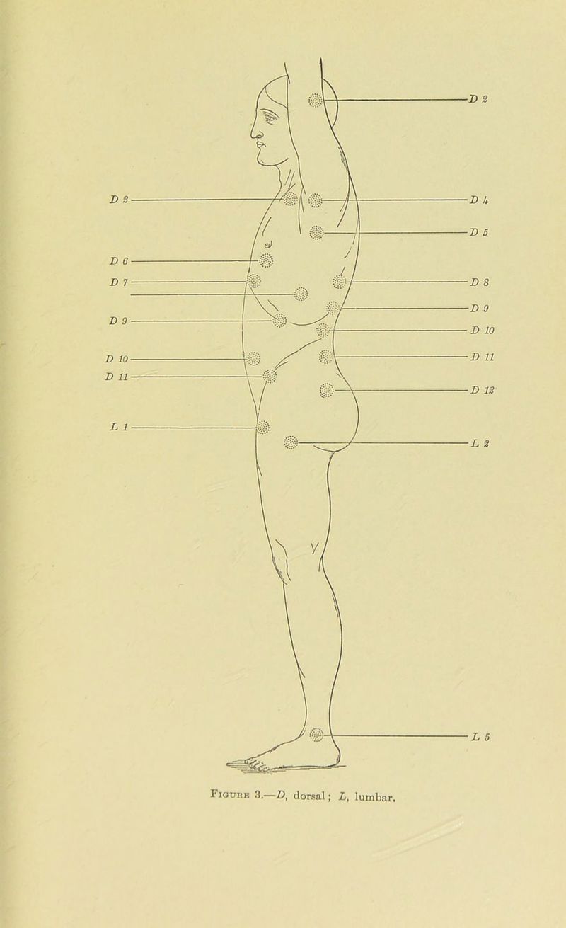 Figure 3.—D, dorsal; L, lumbar.