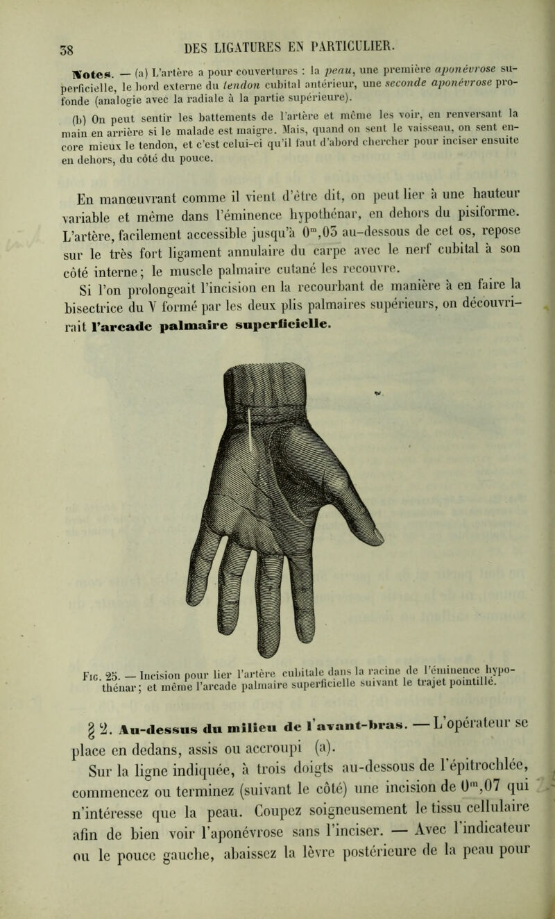 TVote«s. — fa) L’artère a pour couvertures ; la penu, une première npoiiêvrose su- perficielie, le bord externe du tendon cubital antérieur, une seconde aponévrose pro- fonde (analogie avec la radiale à la partie supérieure). (b) On peut sentir les battements de l’artère et même les voir, en renversant la main en arrière si le malade est maigre. Mais, quand on sent le vaisseau, on sent en- core mieux le tendon, et c’est celui-ci qu’il faut d’abord chercber pour inciser ensuite en dehors, du côté du pouce. En manœuvrant comme il vient d’etre dit, on peut lier a une hauteui variable et même dans l’éminence hypotliénar, en dehors du pisiforme. L’artère, facilement accessible jusqu’à 0“,0o au-dessous de cet os, repose sur le très fort ligament annulaire du carpe avec le nerf cubital à son côté interne; le muscle palmaire cutané les recouvre. Si l’on prolongeait l’incision en la recourbant de manière à en faire la bisectrice du forme par les deux plis palmaires supeiieuis, on décoiiAli- rait l’arcade palmaire superfleîelle. Fig. 25. — Incision pour lier l’iirtère cubitale dans thénar; et même l’arcade palmaire superficielle la racine de l’éminence bypo- suivant le trajet pointillé. g '2. Au-dessus du milieu de l’arant-bras. — L’opéiatcill se place en dedans, assis ou accroupi (a). Sur la ligne indiquée, à trois doigts au-dessous de 1 épitioclilce, commencez ou terminez (suivant le côté) une incision de 0'“,07 qui n’intéresse que la peau. Coupez soigneusement le tissu cellulaire afin de bien voir l’aponévrose sans l’inciser. — Avec 1 indicateui ou le pouce gauche, abaissez la lèvre postérieure de la peau pour
