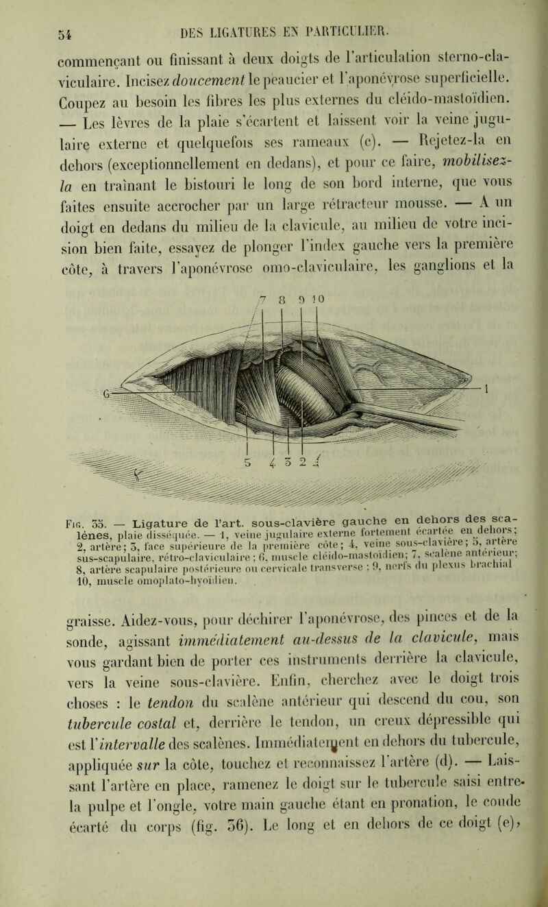 comniGnçaiit ou finissant a deux doigts de 1 articulation steino-cla- xiculaire. Incisezdowccmeuf lepeaucier et l’aponévrose superficielle. Coupez au besoin les fibres les plus externes du cléido-masloïdien. — Les lèvres de la plaie s'écartent et laissent voir la veine jugu- laire externe et quelquefois ses rameaux (c). — Rejetez-la en dehors (exceptionnellement en dedans), et pour ce faire, mobilisez- la en traînant le bistouri le long de son bord interne, que vous faites ensuite accrocher par un large rétracteur mousse. — A un doigt en dedans du milieu de la clavicule, au milieu de votre inci- sion bien faite, essayez de plonger l’index gauche vers la première cote, à travers l’aponévrose omo-claviculaire, les ganglions et la ,7 a 9 10 Fifi. 35. — Ligature de l’art, sous-clavière gauche en dehors des sca- lénes, plaie disséiiuée. — 1, veine jufjulaive externe fortement ecrndee 6^ t ® 2. artère: 3, face supérieure de la ])reinière côte; 4, veine sous-claviere; sus-scapulaire, rétro-claviculaire ; fi, muscle cléido-mastoidien; 7. scalene an ei leur. 8, artère scapulaire postérieure ou cervicale transverse ; 0, ncrls du plexus Pranu.u 10, muscle omoplato-liyoïdieu. graisse. Aidez-vous, pour déchirer l’aponévrose, des pinces et de la sonde, agissant wimédiaternent au-dessus de la clavicule, mais vous gardant bien de porter ces instrumenis denâère la clavicnle, vers la veine sous-clavière. Enfin, cherchez avec le doigt tiois choses : le tendon du scalène antérieur qui descend du cou, son tubercule costal et, derrière le tendon, un creux dépressible qui est Vintervalle des scalènes. Immédiateiyent en dehors du tubercule, appliquée sur la côte, touchez et reconnaissez 1 artère (d). Lais- sant l’artère en place, ramenez le doigt sur le tubercnle saisi entre- la pulpe et l’ongle, votre main gauche étant en pronation, le coude écarté du corps (fig. 5G). l.e long et en dehors de ce doigt (e)?