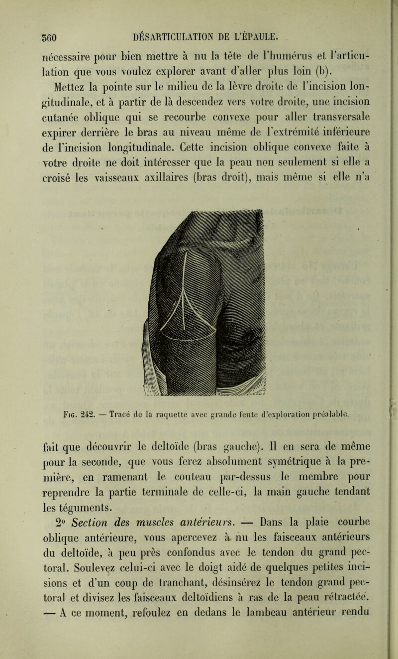 nécessaire pour bien mettre à nu la tête de riiumérus et l’articu- lation que vous voulez explorer avant d’aller plus loin (b). Mettez la pointe sur le milieu de la lèvre droite de l’incision lon- gitudinale, et à partir de là descendez vers votre droite, une incision cutanée oblique qui se recourbe convexe pour aller transversale expirer derrière le bras au niveau même de l’extrémité inférieure de l’incision longitudinale. Cette incision oblique convexe faite à votre droite ne doit intéresser que la peau non seulement si elle a croisé les vaisseaux axillaires (bras droit), mais même si elle n’a fait que découvrir le deltoïde (bras gauche). 11 en sera de même pour la seconde, que vous ferez absolument symétrique à la pre- mière, en ramenant le couteau par-dessus le membre pour reprendre la partie terminale de celle-ci, la main gauche tendant les téguments. 2“ Section des muscles antérieurs. — Dans la plaie courbe oblique antérieure, vous apercevez à, nu les faisceaux antérieurs du deltoïde, à peu près confondus avec le tendon du grand pec- toral. Soulevez celui-ci avec le doigt aidé de quelques petites inci- sions et d’un coup de tranchant, désinsérez le tendon grand pec- toral et divisez les faisceaux deltoïdiens à ras de la peau rétractée. — A ce moment, refoulez en dedans le lambeau antérieur rendu