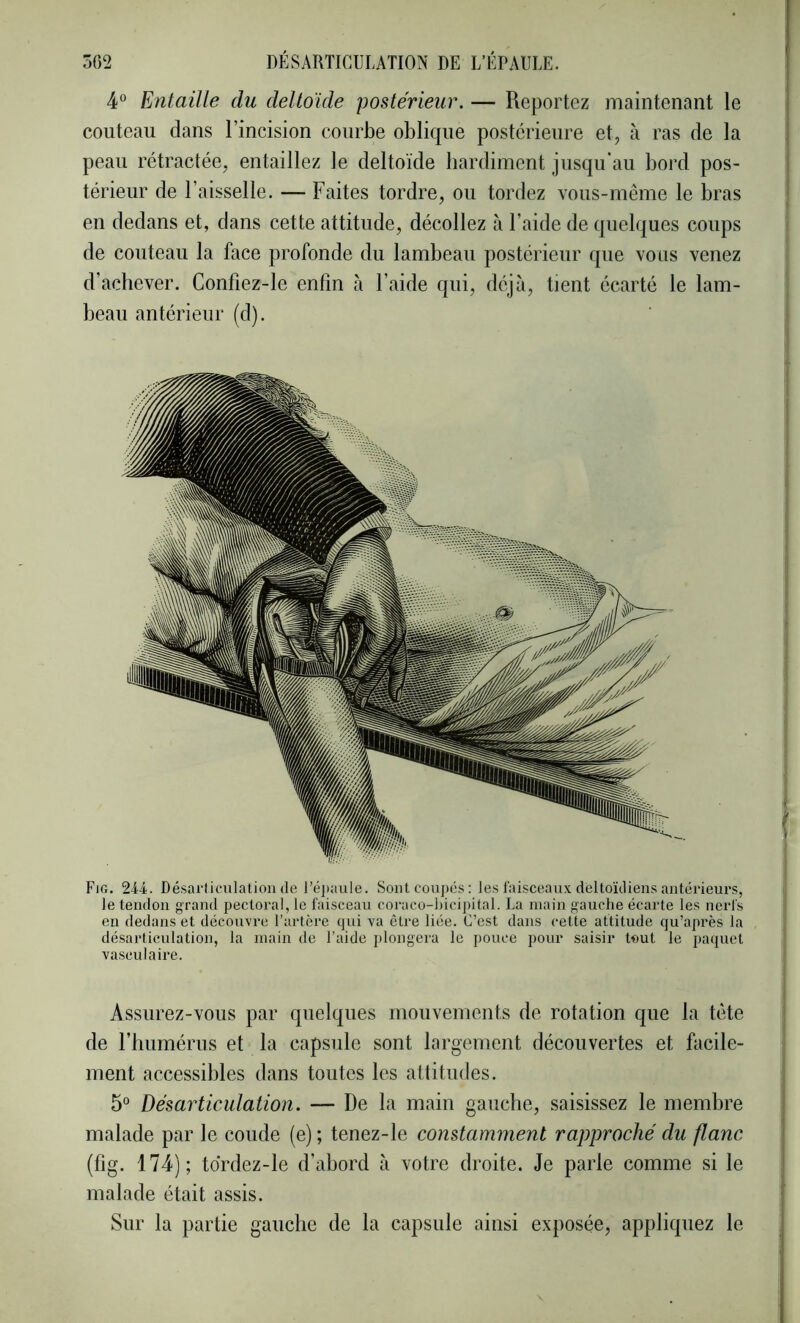 4“ Entaille du deltoïde postérieur. — Reportez maintenant le couteau dans l’incision courbe oblique postérieure et, à ras de la peau rétractée, entaillez le deltoïde bardiment jusqu’au bord pos- térieur de l’aisselle. — Faites tordre, ou tordez vous-même le bras en dedans et, dans cette attitude, décollez à l’aide de quelques coups de couteau la face profonde du lambeau postérieur que vous venez d’achever. Confiez-le enfin à l’aide qui, déjà, tient écarté le lam- beau antérieur (d). Fig. 244. Dé.sarticulatioii de réjiaule. Sontcoujiés: le.s faisceaux deltoïdiens antérieurs, le tendon grand pectoral, le faisceau coraco-bicipital. La main gauche écarte les nerfs en dedans et découvre l’artère qui va être liée. C’est dans cette attitude qu’après la désarticulation, la main de l’aide plongera le pouce pour saisir tout le paquet vasculaire. Assurez-vous par quelques mouvements de rotation que la tête de rhumérus et la capsule sont largement découvertes et facile- ment accessibles dans toutes les attitudes. 5“ Désarticulation. — De la main gauche, saisissez le membre malade par le coude (e) ; tenez-le constamment rapproché du flanc (fig. 174); tdrdez-le d’abord à votre droite. Je parle comme si le malade était assis. Sur la partie gauche de la capsule ainsi exposée, appliquez le