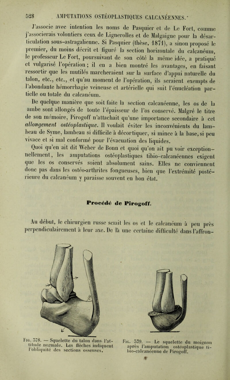 J’associe avec intention les noms de Pasqnier et de Le Fort, comme j’associerais volontiers ceux de Lignerolles et de Malgaigue pour la désar- ticulation sous-astragalienne. Si Pasqnier (thèse, 1871), a smon proposé le piemier, du moins décrit et figuré la section horizontale du calcanéum, le piofesseur Le Fort, poursuivant de son cote la même idée, a pratiqué et vulgarisé 1 opération ; il en a bien montré les avantages, en faisant lessortir que les mutiles marcheraient sur la surface d’appui naturelle du talon, etc., etc., et qu au moment de l’opération, ils seraient exempts de 1 abondante hémorrhagie veineuse et artérielle qui suit l’énucléation par- tielle ou totale du calcanéum. De quelque manière que soit faite la section calcanéenne, les os de la amhe sont allongés de toute l’épaisseur de l’os conservé. Malgré le titre de son mémoire, Pirogoff n’attachait qu’une importance secondaire à cet allongement ostéoplastique. Il voulait éviter les inconvénients du lam- beau de Syme, lambeau si difficile à décortiquer, si mince à la base, si peu vivace et si mal conformé pour l’évacuation des liquides. Quoi qu en ait dit Weber de Bonn et quoi qu’on ait pu voir exception- nellement, les amputations ostéoplastiques tihio-calcanéennes exigent que les os conserves soient absolument sains. Elles ne conviennent donc pas dans les ostéo-arthrites fongueuses, bien que l’extrémité posté- rieure du calcanéum y paraisse souvent en bon état. Procédé de Pirogoff. Au début, le chirurgien russe sciait les os et le calcanéum à peu près perpendiculairement à leur axe. De là une certaine difliculté dans l’affrou- I iG. 378. — Squelette du talon dans l’at- titude normale. Les flèches indiquent l’obliquité des sections osseuses. Fig. 579. — Le squelette du moignon ajirès l’amputation ostéoplastique li- l»io-calcanéenne de Pirogol'f. t