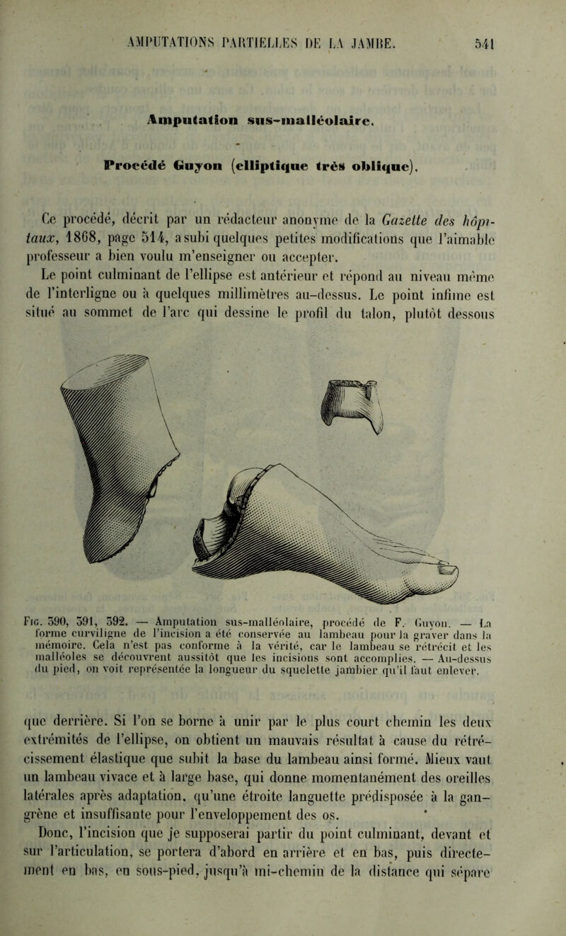 Amputation sus->iiialléolairc. Procédé Gu^on (elliptique très oblique). Ce procédé, décrit par un rédacteur anonyme de la Gazette des hôpi- taux, 1808, page 514, asubi quelques petites modifications que l’aimable professeur a bien voulu m’enseigner ou accepter. Le point culminant de l’ellipse est antérieur et répond au nivctau mémo de l’interligne ou à quelques millimètres au-dessus. Le point infime est situé au sommet de l’arc qui dessine le profil du talon, plutôt dessous Fig. 590, 391, 592. — Amputation sus-malléolaire, procédé de F. Guyou. — Ua forme curviligne de l’incision a été conservée au lambeau pour la graver dans la mémoire. Cela n’est pas conforme à la vérité, car le lambeau se rétrécit et les malléoles se découvrent aussitôt que les incisions sont accomplies. — Au-dessus du pied, on voit représentée la longueur du squelette jambier qu’il faut enlever. que derrière. Si l’on se borne à unir par le plus court chemin les deux extrémités de l’ellipse, on obtient un mauvais résultat à cause du rétré- cissement élastique que subit la base du lambeau ainsi formé. Mieux vaut un lambeau vivace et à large base, qui donne momentanément des oreilles latérales après adaptation, qu’une étroite languette prédisposée à la gan- grène et insuffisante pour l’enveloppement des os. Donc, l’incision que je supposerai partir du point culminant, devant et sur l’articulation, se portera d’abord en arrière et en bas, puis directe- ment en bas, en sous-pied, jusqu’à mi-chemin de la distance qui sépare