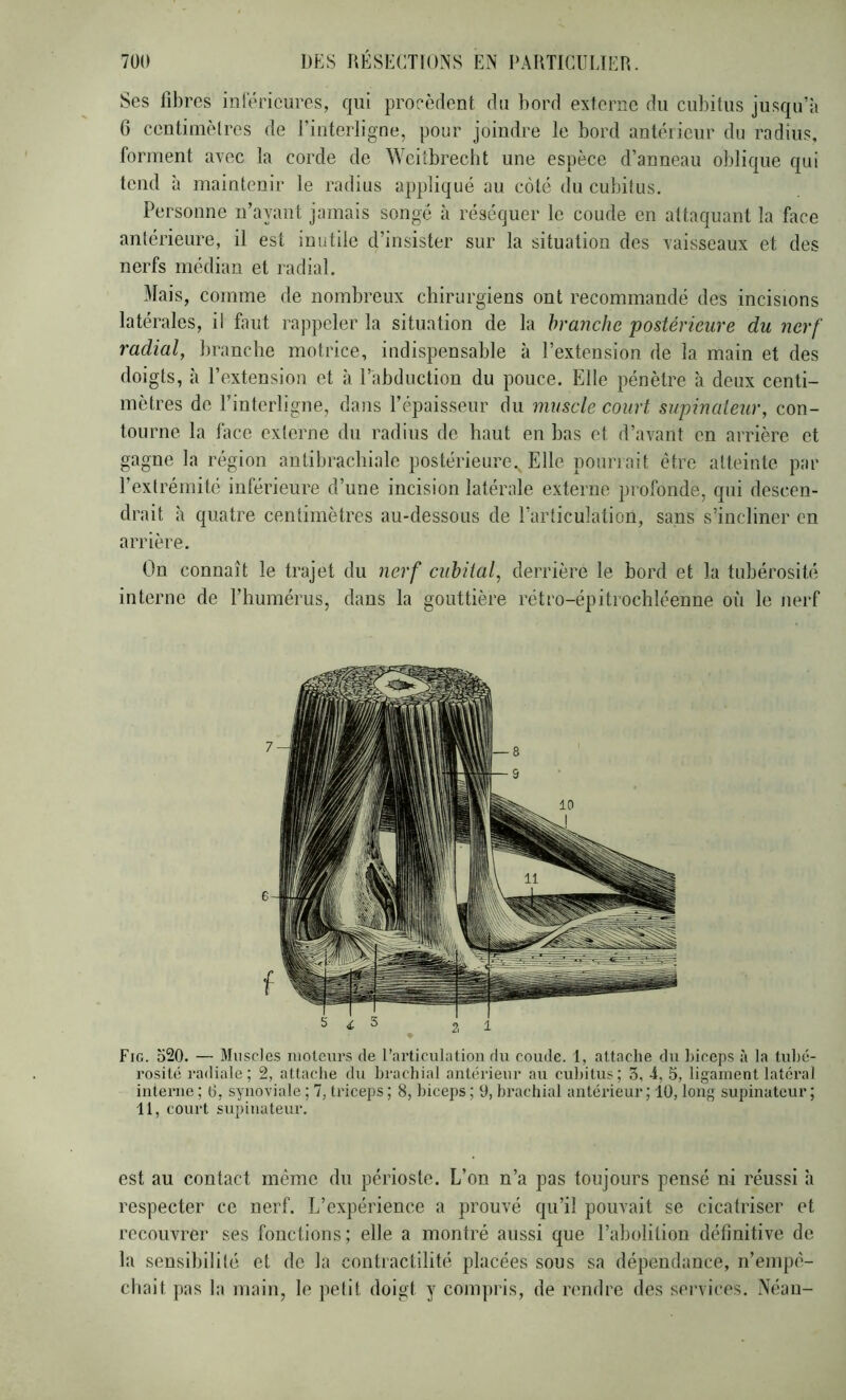 Ses fibres inférieures, qui procèdent du bord externe du cubitus jusqu’à G centimètres de l’interligne, pour joindre le bord antérieur du radius, forment avec la corde de Weitbrecbt une espèce d’anneau oblique qui tend à maintenir le radius appliqué au côté (lu cubitus. Personne n’ayant jamais songé à réséquer le coude en attaquant la face antérieure, il est inutile d’insister sur la situation des vaisseaux et des nerfs médian et radial. Mais, comme de nombreux chirurgiens ont recommandé des incisions latérales, il faut rappeler la situation de la branche postérieure du nerf radial, branche motrice, indispensable à l’extension de la main et des doigts, à l’extension et à l’abduction du pouce. Elle pénètre à deux centi- mètres de l’interligne, dans l’épaisseur du muscle court supinateur, con- tourne la face externe du radius de haut en has et d’avant en arrière et gagne la région antibrachiale postérieure.^ Elle pourrait être atteinte par rextrémitc inférieure d’une incision latérale externe profonde, qui descen- drait à quatre centimètres au-dessous de l’articulation, sans s’incliner en arrière. On connaît le trajet du nerf cubital, derrière le hord et la tubérosité interne de l’humérus, dans la gouttière rétro-épitrochléenne où le nerf Fig. 520. — Muscles moteurs de l’articulation du coude. 1, attache du biceps à la tului- rosiU; radiale; 2, attache du brachial antérieur au cubitus; 3, 4, 5, ligament latéral interne ; 6, synoviale ; 7, triceps ; 8, biceps ; 9, brachial antérieur ; 10, long supinateur ; 11, court supinateur. est au contact même du périoste. L’on n’a pas toujours pensé ni réussi à respecter ce nerf. L’expérience a prouvé qu’il pouvait se cicatriser et recouvrer ses fonctions; elle a montré aussi que l’abolition définitive de la sensibilité et de la contractilité placées sous sa dépendance, n’empé- cbait pas la main, le petit doigt y compris, de rendre des services. Néau-