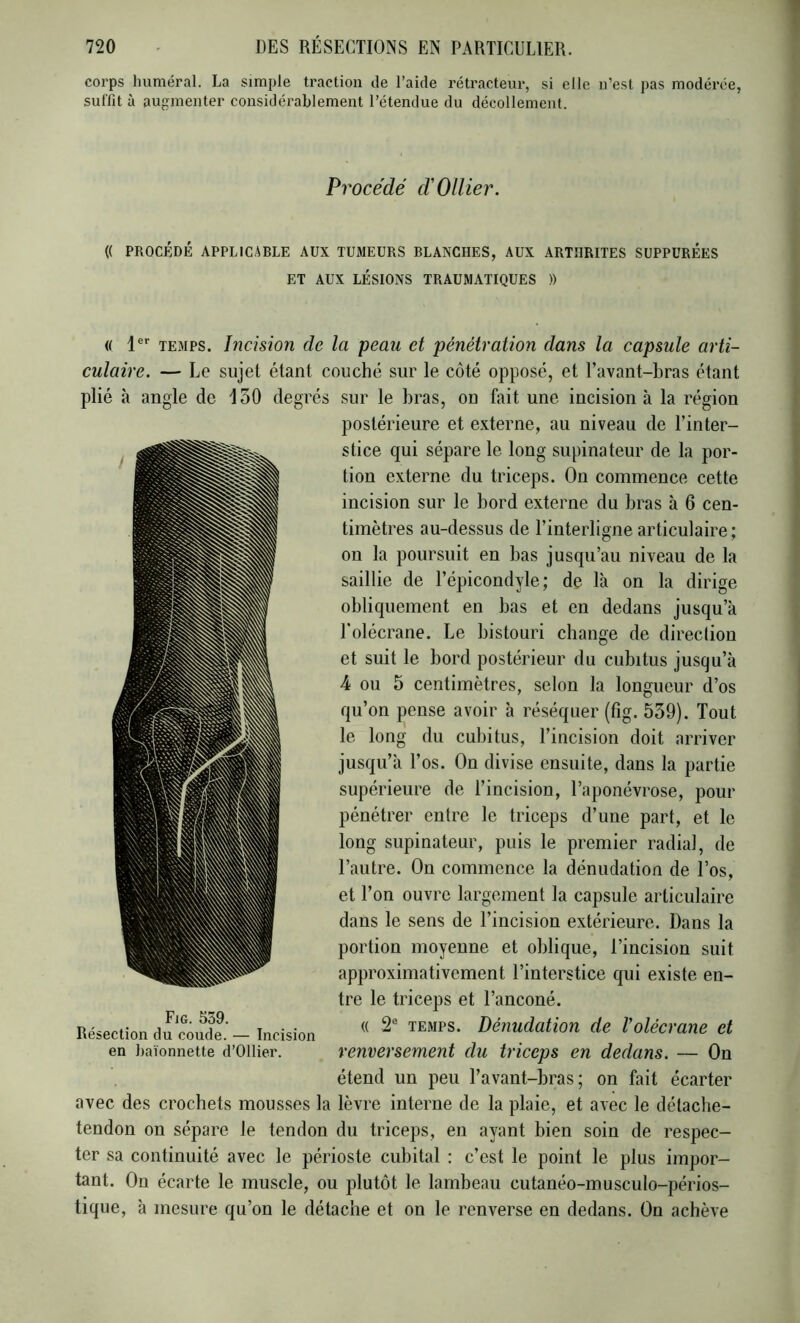 corps huméral. La simple traction de l’aide rétracteur, si elle n’est pas modérée, suffit à auj^menter considérablement l’étendue du décollement. Procédé d'Ollier. (( PROCÉDÉ APPLICABLE AUX TUMEURS BLANCHES, AUX ARTHRITES SUPPÜRÉES ET AUX LÉSIONS TRAUMATIQUES )) « 1®'’ TEMPS. Incision de la peau et pénétration dans la capsule arti- culaire. — Le sujet étant couché sur le côté opposé, et Uavant-bras étant plié à angle de 150 degrés sur le bras, on fait une incision à la région postérieure et externe, au niveau de l’inter- stice qui sépare le long supinateur de la por- tion externe du triceps. On commence cette incision sur le bord externe du bras à 6 cen- timètres au-dessus de l’interligne articulaire; on la poursuit en bas jusqu’au niveau de la saillie de l’épicondyle; de là on la dirige obliquement en bas et en dedans jusqu’à Uolécrane. Le bistouri change de direclion et suit le bord postérieur du cubitus jusqu’à 4 ou 5 centimètres, selon la longueur d’os qu’on pense avoir à réséquer (fig. 539). Tout le long du cubitus, l’incision doit arriver jusqu’à l’os. On divise ensuite, dans la partie supérieure de l’incision, l’aponévrose, pour pénétrer entre le triceps d’une part, et le long supinateur, puis le premier radial, de l’autre. On commence la dénudation de l’os, et l’on ouvre largement la capsule articulaire dans le sens de l’incision extérieure. Dans la portion moyenne et oblique, l’incision suit approximativement l’interstice qui existe en- tre le triceps et l’anconé. (( 2® TEMPS. Dénudation de l'olécrane et renversement du triceps en dedans. — On étend un peu Tavant-bras; on fait écarter avec des crochets mousses la lèvre interne de la plaie, et avec le détacbe- tendon on sépare le tendon du triceps, en ayant bien soin de respec- ter sa continuité avec le périoste cubital : c’est le point le plus impor- tant. On écarte le muscle, ou plutôt le lambeau cutanéo-musculo-périos- tique, à mesure qu’on le détache et on le renverse en dedans. On achève Fjg. 559. Résection du coude. — Incision en baïonnette d’Ollier.