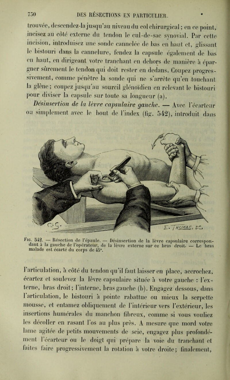 trouvée, (lescondcz-la jusqu’au niveau du coleliirurpi'ieai ; en ee point, incisez au coté externe du tendon le cul-de-sac synovial. Par cette incision, introduisez nue sonde cannelée de bas en haut et, Lotissant le bistouri dans la cannelure, fendez la capsule également de bas en haut, en dirigeant votre tranchant en dehors de manière à épar- gner sûrement le tendon qui doit rester en dedans. Coupez progres- sivement, comme pénètre la sonde qui ne s’arrête qu’en touchant la glène; coupez jusqu’au sourcil glénoïdien en relevant le bistouri pour diviser la capsule sur toute sa longueur (a). Désinsertion de la lèvre capsulaire gauche. — Avec l’écarteur ou simplement avec le bout de l’index (fig. 542), introduit dans Fig. 542. — Résection de l’épaule. — Désinsertion de la lèvre capsulaire correspon- dant à la gauche de l’opérateur, de la lèvre externe sur ce hras droit. — Le bras malade est écarté du corps de 45. 1 articulation, a coté du tendon qu’il faut laisser en place, accrochez, écartez et soulevez la lèvre capsulaire située à votre gauche : l’ex- terne, hras droit; l’interne, hras gauche (h). Engagez dessous, dans 1 articulation, le bistouri à pointe rabattue ou mieux la serpette mousse, et entamez obliquement de l’intérieur vers l’extérieur, les insertions humérales du manchon fibreux, comme si vous vouliez les décoller en rasant l’os au plus près. A mesure que mord votre lame agitée de petits mouvements de scie, engagez plus profondé- ment l’écarteur ou le doigt qui prépare la voie du traïudiant et faites taire progressivement la rotation à votre droite; finalement,