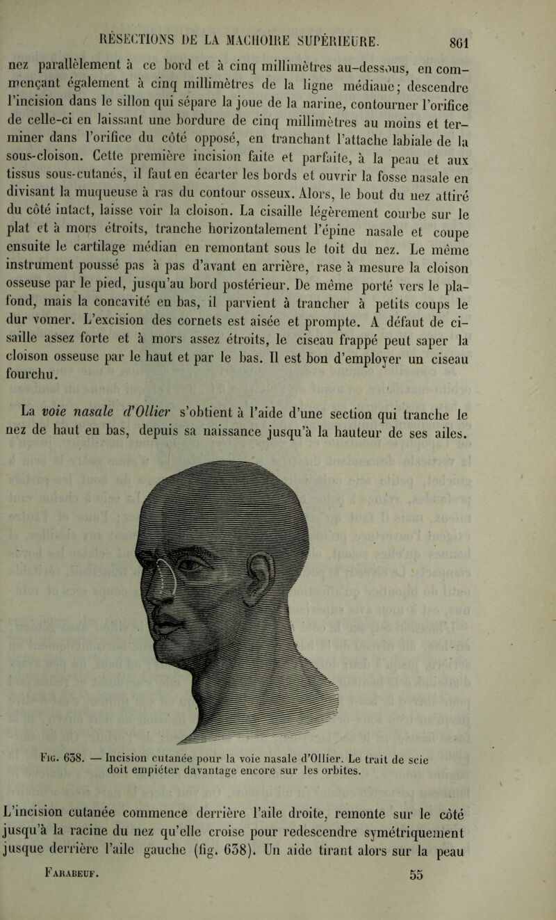 nez parallèlement à ce bord et à cinq millimètres au-dessvUis, en com- mençant également à cinq millimètres de la ligne médiane; descendre l’incision dans le sillon qui sépare la joue de la narine, contourner l’orifice de celle-ci en laissant une bordure de cinq millimètres au moins et ter- miner dans l’orifice du côté opposé, en tranchant l’attache labiale de la sous-cloison. Cette première incision faite et parfaite, à la peau et aux tissus sous-cutanés, il faut en écarter les bords et ouvrir la fosse nasale en divisant la muqueuse à ras du contour osseux. Alors, le bout du nez attiré du côté intact, laisse voir la cloison. La cisaille légèrement courbe sur le plat et à mors étroits, tranche horizontalement l’épine nasale et coupe ensuite le cartilage médian en remontant sous le toit du nez. Le même instrument poussé pas à pas d’avant en arrière, rase à mesure la cloison osseuse par le pied, jusqu’au bord postérieur. De même porté vers le pla- lond, mais la concavité en bas, il parvient à trancher à petits coups le dur vomer. L’excision des cornets est aisée et prompte. A défaut de ci- saille assez forte et à mors assez étroits, le ciseau frappé peut saper la cloison osseuse par le haut et par le bas. Il est bon d’employer un ciseau fourchu. La voie nasale cVOllicv s’obtient à l’aide d’une section qui tranche le nez de haut eu bas, depuis sa naissance jusqu’à la hauteur de ses ailes. Fig. 658. — Incision cutanée pour la voie nasale d’Ollier. Le trait de scie doit empiéter davantage encore sur les orbites. L’incision cutanée commence derrière l’aile droite, remonte sur le côté jusqu’à la racine du nez qu’elle croise pour redescendre symétriquement jusque derrière l’aile gauche (fig. 638). Un aide tirant alors sur la peau Farabeuf. 55