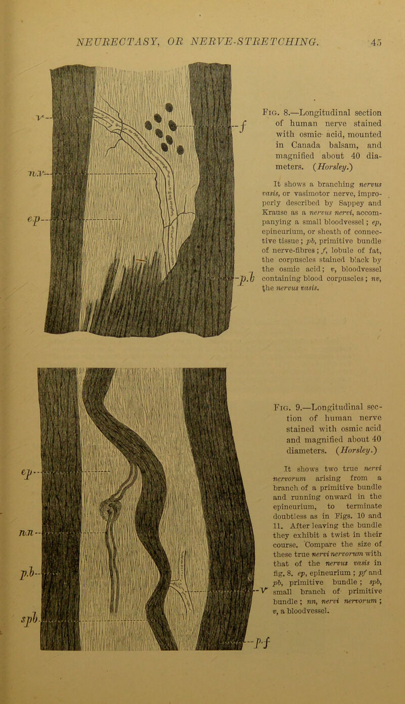 Fig. 8.—Longitudinal section of human nerve stained with osmic- acid, mounted in Canada balsam, and magnified about 40 dia- meters. (Horsley.) It shows a branching nervus vasis, or vasimotor nerve, impro- perly described by Sappey and Krause as a nervus nervi, accom- panying a small bloodvessel; ep, epineurium, or sheath of connec- tive tissue ; pi, primitive bundle of nerve-fibres ; /, lobule of fat, the corpuscles stained black by the osmic acid; v, bloodvessel containing blood corpuscles; nv, the nervus vasis. Fig. 9.—Longitudinal sec- tion of human nerve stained with osmic acid and magnified about 40 diameters. (Horsley.) It shows two true nervi nervorum arising from a branch of a primitive bundle and running onward in the epineurium, to terminate doubtless as in Pigs. 10 and 11. After leaving the bundle they exhibit a twist in their course. Compare the size of these true nervi nervorum with that of the nervus vasis in fig. 8. ep, epineurium ; pf and pi, primitive bundle; spi, small branch of primitive bundle ; nn, nervi nervorum ; v, a bloodvessel.