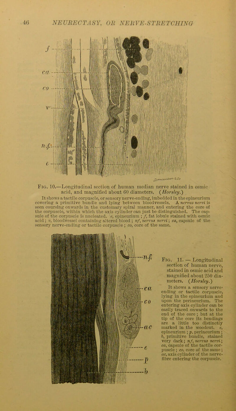 Fig. 10.—Longitudinal section of human median nerve stained in osmic acid, and magnified about 60 diameters. ( Horsley.') It shows a tactile corpuscle, or sensory nerve-ending, imbedded in the epineurium covering a primitive bundle and lying between bloodvessels. A nervus nervi is seen coursing onwards in the customary spiral manner, and entering the core of the corpuscle, within which the axis cylinder can just be distinguished. The cap- sule of the corpuscle is nucleated, e, epineurium ; /, fat lobule stained with osmic acid; v, bloodvessel containing altered blood ; nf, nervus nervi; ca, capsule of the sensory nerve-ending or tactile corpuscle ; co, core of the same. Fig. 11. — Longitudinal section of human nerve, stained in osmic acid and magnified about 250 dia- meters. (Horsley.) It shows a sensory nerve- ending or tactile corpuscle, lying in the epineurium and upon the perineurium. The entering axis cylinder can be easily traced onwards to the end of the core ; but at the tip of the core its bendings are a little too distinctly marked in the woodcut, e, epineurium ; p, perineurium ; b, primitive bundle, stained very dark; nf, nervus nervi; ca, capsule of the tactile cor- puscle ; co, core of the same; ac, axis cylinder of the nerve- fibre entering the corpuscle.