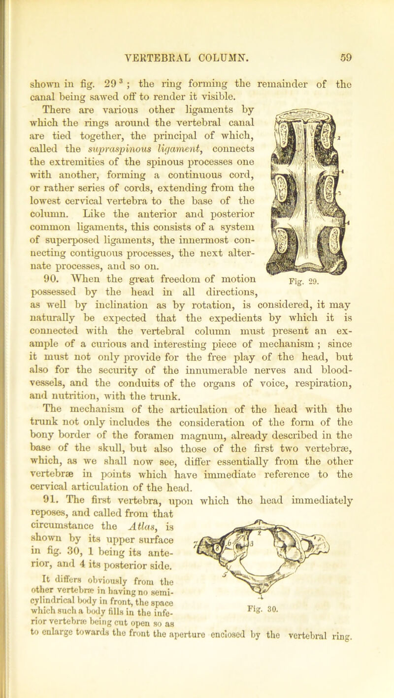 shown in fig. 293 ; the ring forming the remainder of the canal being sawed off to render it visible. There are various other ligaments by which the rings around the vertebral canal are tied together, the principal of which, called the supraspinous lic/ament, connects the extremities of the spinous processes one with another, forming a continuous cord, or rather series of cords, extending from the lowest cervical vertebra to the base of the column. Like the anterior and posterior common ligaments, this consists of a system of superposed ligaments, the innermost con- necting contiguous processes, the next alter- nate processes, and so on. 90. When the great freedom of motion possessed by the head in all directions, as well by inclination as by rotation, is considered, it may naturally be expected that the expedients by which it is connected with the vertebral column must present an ex- ample of a curious and interesting piece of mechanism ; since it must not only provide for the free play of the head, but also for the security of the innumerable nerves and blood- vessels, and the conduits of the organs of voice, respiration, and nutrition, with the trunk. The mechanism of the articulation of the head with the trunk not only includes the consideration of the form of the bony border of the foramen magnum, already described in the base of the skull, but also those of the first two vertebrae, which, as we shall now see, differ essentially from the other vertebrae in points which have immediate reference to the cervical articulation of the head. 91. The first vertebra, upon which the head immediately reposes, and called from that circumstance the Atlas, is shown by its upper surface in fig. 30, 1 being its ante- rior, and 4 its posterior side. It differs obviously from the other vertebra; in having no semi- cylindrical body in front, the space which such a body fills in the infe- rior vertebra; being cut open so as to enlarge towards the front the aperture enclosed by the vertebral ring.