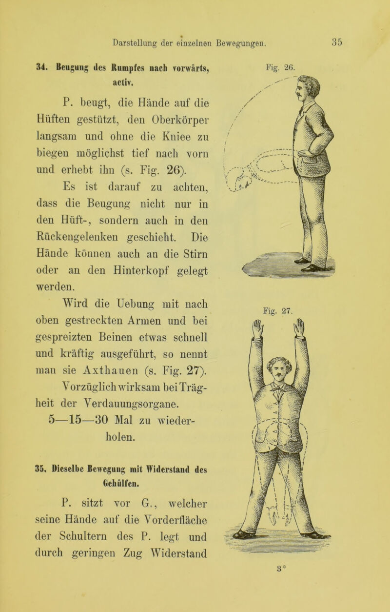 34. Beugung des Uiiiiipfes nach vorwärts, activ. P. beugt, die Hände auf die Hüften gestützt, den Oberkörper langsam und oline die Kniee zu biegen mögliclist tief nach vorn und erhebt ihn (s. Fig. 26). Es ist darauf zu achten, dass die Beugung nicht nur in den Hüft-, sondern auch in den Rückengelenken geschieht. Die Hände können auch an die Stirn oder an den Hinterkopf gelegt werden. Wird die Uebung mit nach oben gestreckten Armen und bei gespreizten Beinen etwas schnell und kräftig ausgeführt, so nennt man sie Axthauen (s. Fig. 27). Vorzüglich wirksam bei Träg- heit der Verdauungsorgane. 5—15—30 Mal zu wieder- holen. 35. Dieselbe Bewegung mit Wülerstami des Ciehulfen. P. sitzt vor G., welcher seine Hände auf die VorderÜäche der Schultern des P. legt und durch geringen Zug Widerstand Fig. 27. 3-‘