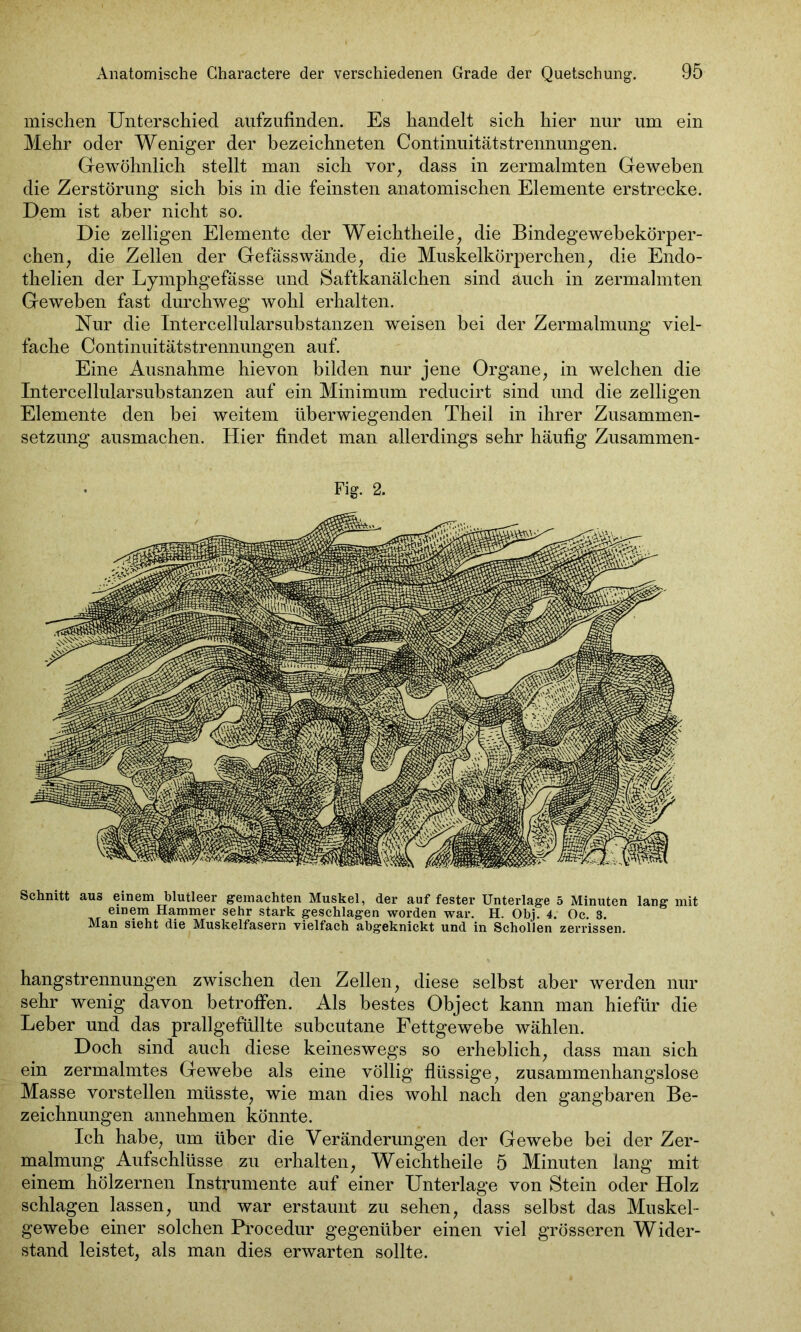 mischen Unterschied aufzufinden. Es handelt sich hier nur um ein Mehr oder Weniger der bezeichneten Continuitätstrennungen. Gewöhnlich stellt man sich vor, dass in zermalmten Geweben die Zerstörung sich bis in die feinsten anatomischen Elemente erstrecke. Dem ist aber nicht so. Die zelligen Elemente der Weichtheile, die Bindegewebekörper- chen, die Zellen der Gefässwände, die Muskelkörperchen, die Endo- thelien der Lymphgefässe und Saftkanälchen sind äuch in zermalmten Geweben fast durchweg wohl erhalten. Nur die Intercellularsubstanzen weisen bei der Zermalmung viel- fache Continuitätstrennungen auf. Eine Ausnahme hievon bilden nur jene Organe, in welchen die Intercellularsubstanzen auf ein Minimum reducirt sind und die zelligen Elemente den bei weitem überwiegenden Theil in ihrer Zusammen- setzung ausmachen. Hier findet man allerdings sehr häufig Zusammen- Fig. 2. Schnitt aus einem blutleer gemachten Muskel, der auf fester Unterlage 5 Minuten lang mit einem Hammer sehr stark geschlagen worden war. H. Obj. 4. Oc. 3. Man sieht die Muskelfasern vielfach abgeknickt und in Schollen zerrissen. hangstrennungen zwischen den Zellen, diese selbst aber werden nur sehr wenig davon betroffen. Als bestes Object kann man hiefür die Leber und das prallgefüllte subcutane Fettgewebe wählen. Doch sind auch diese keineswegs so erheblich, dass man sich ein zermalmtes Gewebe als eine völlig flüssige, zusammenhangslose Masse vorstellen müsste, wie man dies wohl nach den gangbaren Be- zeichnungen annehmen könnte. Ich habe, um über die Veränderungen der Gewebe bei der Zer- malmung Aufschlüsse zu erhalten, Weichtheile 5 Minuten lang mit einem hölzernen Instrumente auf einer Unterlage von Stein oder Holz schlagen lassen, und war erstaunt zu sehen, dass selbst das Muskel- gewebe einer solchen Procedur gegenüber einen viel grösseren Wider- stand leistet, als man dies erwarten sollte.