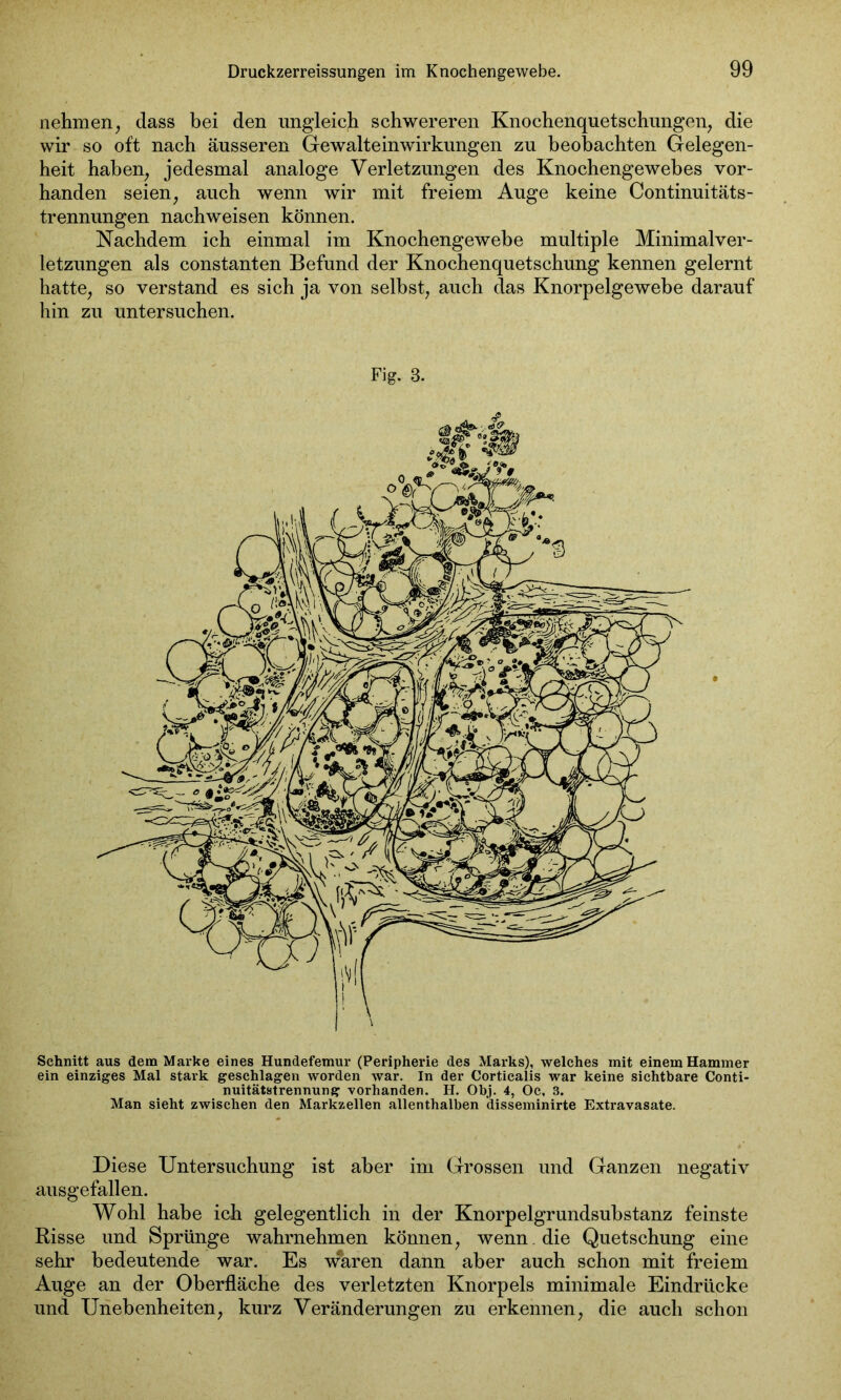 nehmen, dass bei den ungleich schwereren Knochenquetschungen, die wir so oft nach äusseren Gewalteinwirkungen zu beobachten Gelegen- heit haben, jedesmal analoge Verletzungen des Knochengewebes vor- handen seien, auch wenn wir mit freiem Auge keine Continuitäts- trennungen nachweisen können. Nachdem ich einmal im Knochengewebe multiple Minimalver- letzungen als constanten Befund der Knochenquetschung kennen gelernt hatte, so verstand es sich ja von selbst, auch das Knorpelgewebe darauf hin zu untersuchen. Fig. 3. Schnitt aus dem Maxke eines Hundefemur (Peripherie des Marks), welches mit einem Hammer ein einziges Mal stark geschlagen worden war. In der Corticalis war keine sichtbare Conti- nuitätstrennung vorhanden. H. Obj. 4, Oc, 3. Man sieht zwischen den Markzellen allenthalben disseminirte Extravasate. Diese Untersuchung ist aber im Grossen und Ganzen negativ ausgefallen. Wohl habe ich gelegentlich in der Knorpelgrundsubstanz feinste Risse und Sprünge wahrnehmen können, wenn die Quetschung eine sehr bedeutende war. Es wären dann aber auch schon mit freiem Auge an der Oberfläche des verletzten Knorpels minimale Eindrücke und Unebenheiten, kurz Veränderungen zu erkennen, die auch schon