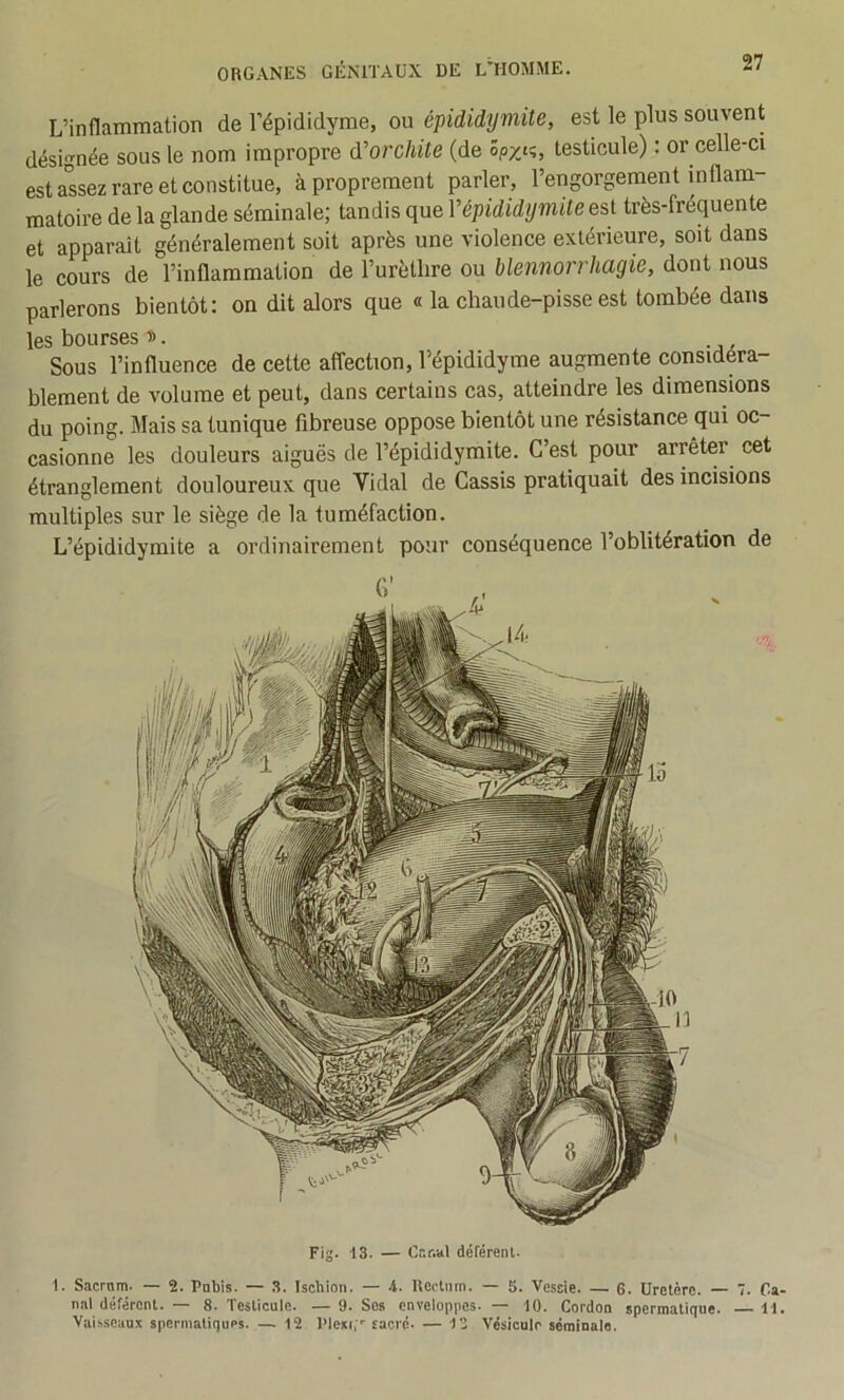 Fig. 13. — Cr.r.al déféreni. 1. Sacrnm. — 2. Pnbis. — 3. Ischion. — i. Rectum. — S. Vessie. — 6. Uretère. — 7. Ca- nal déférent. — 8. Testicule. — 9. Ses enveloppes. — 10. Cordon spermatique. 11. Vaisseaux spermatiques. — 12 Plexi,'' facrp. — 12 Vésicule séminale. L’inflammation de l’épididyme, ou épididymite, est le plus souvent désignée sous le nom impropre d'orchite (de ôpyj^, testicule) : or celle-ci est a'ssez rare et constitue, à proprement parler, l’engorgement inflam- matoire de la glande séminale; tandis que Vépididymite est très-fréquente et apparaît généralement soit après une violence extérieure, soit dans le cours de l’inflammation de l’urètlire ou blennorrhagie, dont nous parlerons bientôt: on dit alors que « la chaude-pisse est tombée dans les bourses D. Sous l’influence de cette affection, l’épididyme augmente considéra- blement de volume et peut, dans certains cas, atteindre les dimensions du poing. Mais sa tunique fibreuse oppose bientôt une résistance qui oc- casionne les douleurs aiguës de l’épididymite. C’est pour arrêter cet étranglement douloureux que Vidal de Cassis pratiquait des incisions multiples sur le siège de la tuméfaction. L’épididymite a ordinairement pour conséquence l’oblitération de