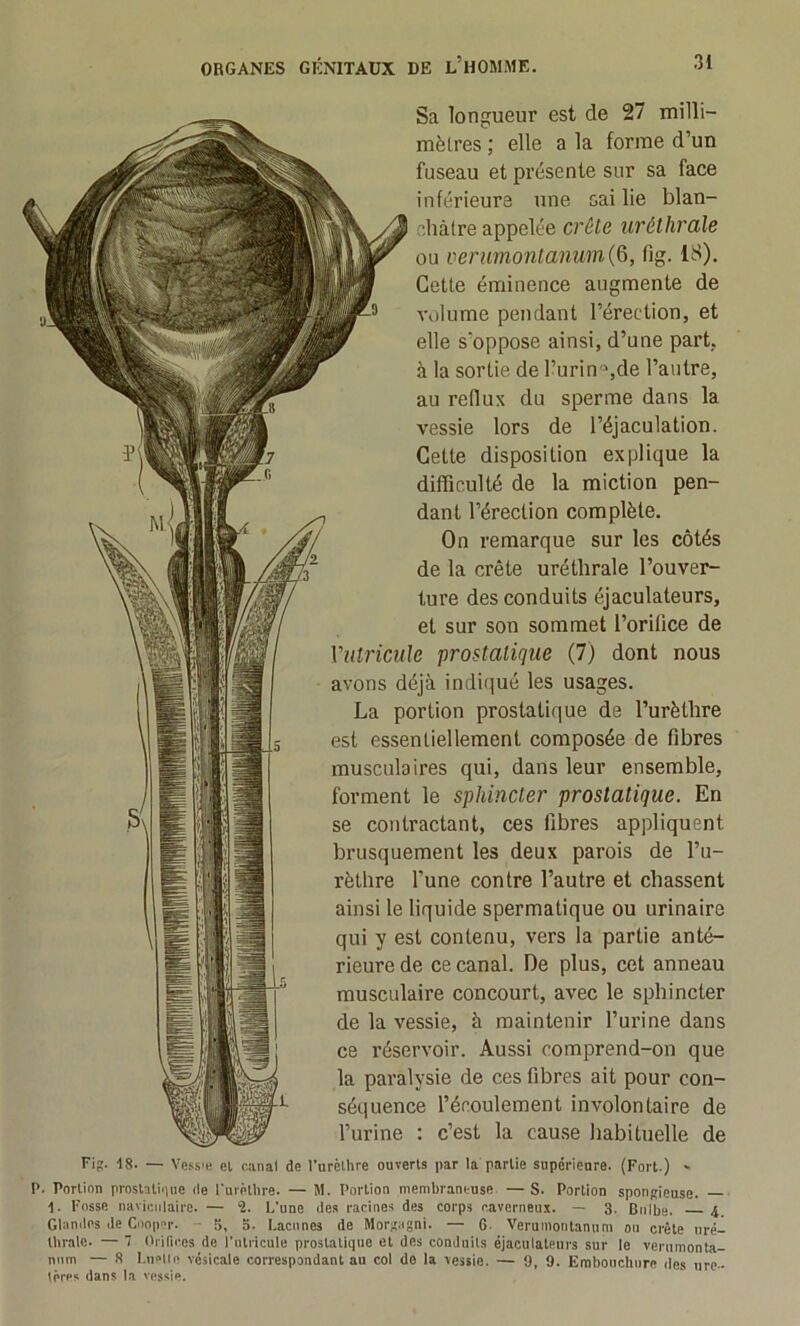 Sa longueur est de 27 milli- mètres ; elle a la forme d’un fuseau et présente sur sa face inférieure une saille blan- châtre appelée crête uréthrale ou verimontanum{Q, fig. 18). Celte éminence augmente de volume pendant l’érection, et elle s'oppose ainsi, d’une part, à la sortie de l’urin-^jde l’autre, au reflux du sperme dans la vessie lors de l’éjaculation. Cette disposition explique la dilTicullé de la miction pen- dant l’érection complète. On remarque sur les côtés de la crête uréthrale l’ouver- ture des conduits éjaculateurs, et sur son sommet l’orilice de Vutricule prostati(]ue (7) dont nous avons déjà indiqué les usages. La portion prostatique de l’urèthre est essentiellement composée de fibres musculaires qui, dans leur ensemble, forment le sphincter prostatique. En se contractant, ces fibres appliquent brusquement les deux parois de l’u- rèthre l’une contre l’autre et chassent ainsi le liquide spermatique ou urinaire qui y est contenu, vers la partie anté- rieure de ce canal. De plus, cet anneau musculaire concourt, avec le sphincter de la vessie, à maintenir l’urine dans ce réservoir. Aussi comprend-on que la paralysie de ces fibres ait pour con- séquence l’écoulement involontaire de l’urine ; c’est la cause habituelle de Fig. -18. — Vess'H el c.anal de l'nrèthre ouverts par la partie supérieure. (Fort.) - P. Portion prostsliiiiie de l’urèthre. — M. Portion membraneuse — S. Portion spongieuse. — 1. Fnsse naviciilaire. — î. L'une des racines des corps caverneux. — 3. Bulbe. 4. Glandes de Coopcr. ~ 5, o. Lacunes de Morgagni. — 6- Verumontanuni ou crête uré- thrale. — 7 Oiifices de l’iitricule prostatique et des conduits éjaculateurs sur le verumonta- num — .8 l.iielle vésicale correspondant au col do la vessie. — 9, 9. Embouchure des urc- lôrps dans la vessie.