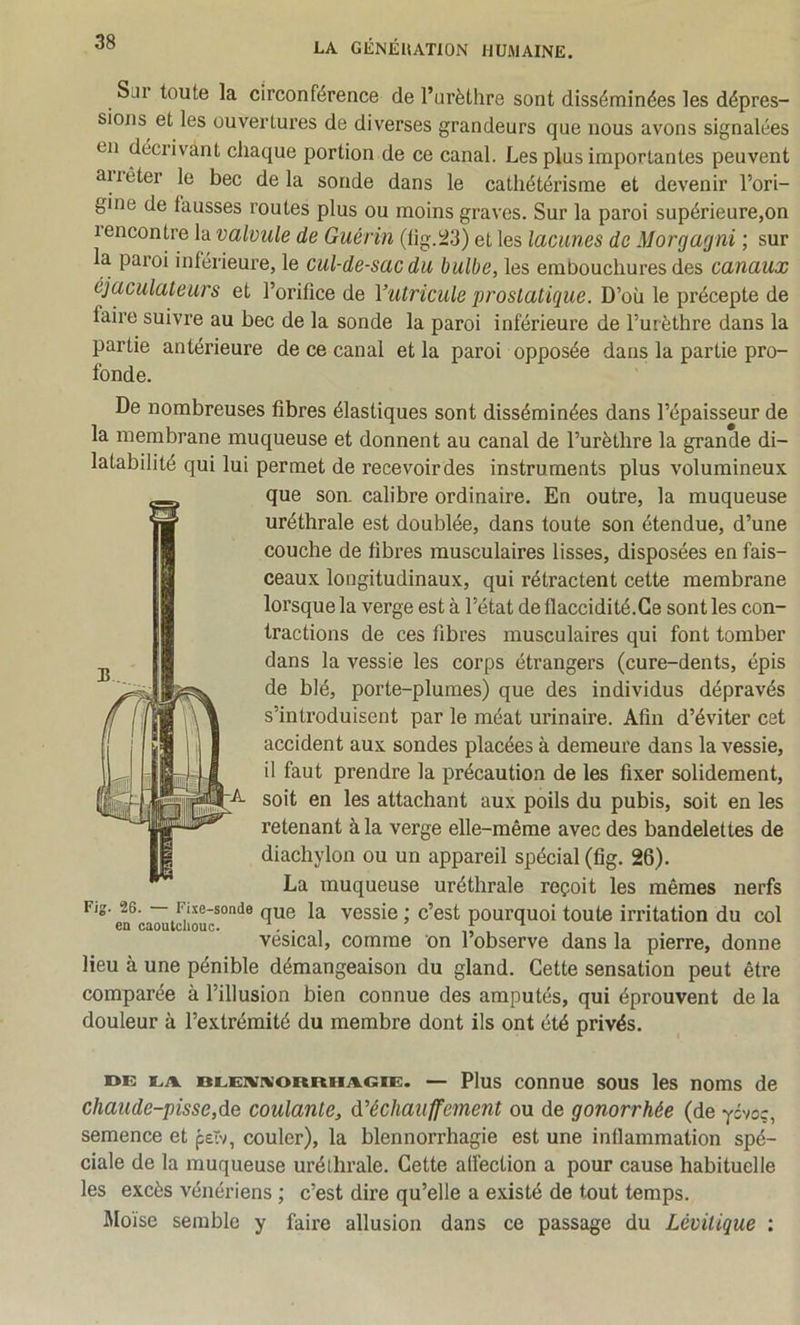 Slh toute la circonférence de l’urèthre sont disséminées les dépres- sions et les ouvertures de diverses grandeurs que nous avons signalées en décrivant chaque portion de ce canal. Les plus importantes peuvent aiiêter le bec de la sonde dans le cathétérisme et devenir l’ori- gine de fausses routes plus ou moins graves. Sur la paroi supérieure,on lencontre la valvule de Guérin (tig.^3) et les lacunes de Morgagni ; sur la paroi inférieure, le cul-de-sac du bulbe, les embouchures des canaux éjaculateurs et l’orifice de Vutricule prostatique. D’où le précepte de faire suivre au bec de la sonde la paroi inférieure de l’urèthre dans la partie antérieure de ce canal et la paroi opposée dans la partie pro- fonde. De nombreuses fibres élastiques sont disséminées dans l’épaisseur de la membrane muqueuse et donnent au canal de l’urèthre la grande di- latabilité qui lui permet de recevoir des instruments plus volumineux que son. calibre ordinaire. En outre, la muqueuse uréthrale est doublée, dans toute son étendue, d’une couche de fibres musculaires lisses, disposées en fais- ceaux longitudinaux, qui rétractent cette membrane lorsque la verge est à l’état de flaccidité.Ce sont les con- tractions de ces fibres musculaires qui font tomber dans la vessie les corps étrangers (cure-dents, épis de blé, porte-plumes) que des individus dépravés s’introduisent par le méat urinaire. Afin d’éviter cet accident aux sondes placées à demeure dans la vessie, il faut prendre la précaution de les fixer solidement, soit en les attachant aux poils du pubis, soit en les retenant à la verge elle-même avec des bandelettes de diachylon ou un appareil spécial (fig. 26). La muqueuse uréthrale reçoit les mêmes nerfs Fig. 26. — Fi.w-sonde que la vessie ; c’est pourquoi toute irritation du col en caoutchouc. . . , , vésical, comme on l observe dans la pierre, donne lieu à une pénible démangeaison du gland. Cette sensation peut être comparée à l’illusion bien connue des amputés, qui éprouvent de la douleur à l’extrémité du membre dont ils ont été privés. DE EA BLENNORRHAGIE. — Plus connue SOUS les noms de chaude-pisse,àQ coulante, d'échaiiffement ou de gonorrhée (de yivoc, semence et peTv, couler), la blennorrhagie est une inflammation spé- ciale de la muqueuse uréthrale. Cette affection a pour cause habituelle les excès vénériens ; c’est dire qu’elle a existé de tout temps. Moïse semble y faire allusion dans ce passage du Lévitique :