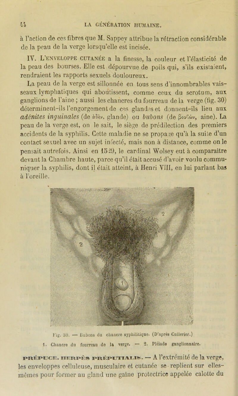 à l’action de ces fibres que M. Sappey attribue la rétraction considérable de la peau de la verge lorsqu’elle est incisée. IV. L’enveloppe cutanée a la finesse, la couleur et l’élasticité de la peau des bourses. Elle est dépourvue de poils qui, s’ils existaient, rendraient les rapports sexuels douloureux. La peau de la verge est sillonnée en tous sens d’innombrables vais- seaux lymphatiques qui aboutissent, comme ceux du scrotum, aux ganglions de l’aine ; aussi les chancres du fourreau de la verge (fig. 30) déterminent-ils l’engorgement de ces glandes et donnent-ils lieu aux adénites inguinales (de à^hv, glande) ou bubons (de (îou%v, aine). La peau de la verge est, on le sait, le siège de prédilection des premiers accidents de la syphilis. Cette maladie ne se propage qu’à la suite d’un contact sexuel avec un sujet infecté, mais non à distance, comme on le pensait autrefois. Ainsi en 1520, le cardinal Wolsey eut à comparaître devant la Chambre haute, parce qu’il était accusé d’avoir voulu commu- niquer la syphilis, dont il était atteint, à Henri VIH, en lui parlant bas à Toreille. PRÉPUCE. RERPÈs pRÉpuxiAi-iK'. — A l’extrémité de la verge, les enveloppes celluleuse, musculaire et cutanée se - replient sur elles- mêmes pour former au gland une gaine protectrice appelée calotte du l-'ig. su. — liuboDS (lu chancre syphilitique. (D’après Cullerier.) 1. Chancre du fourreau de la verge. — 2. Pléiade ganglionnaire.