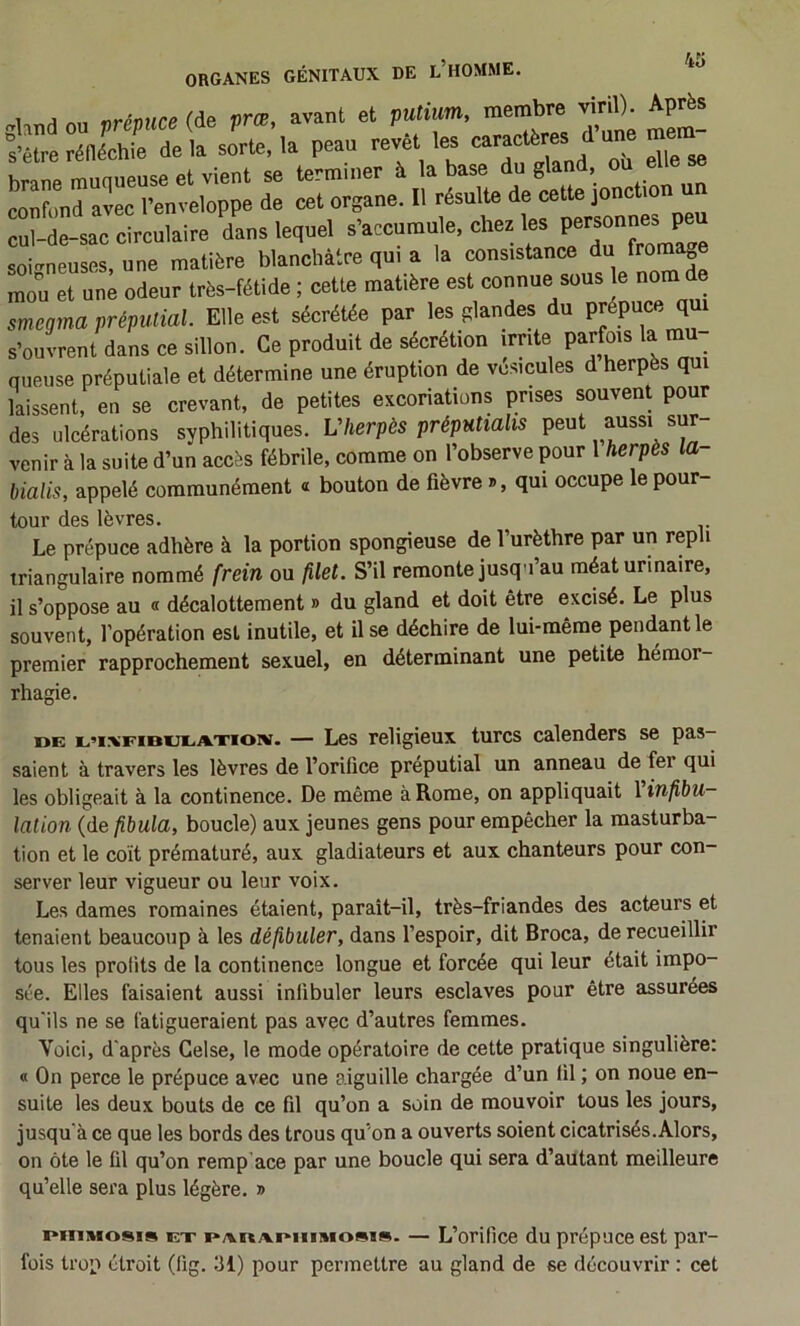 1 J ^rénurp Mp Dræ avant et putium, membre viril). Après “n«e dt a soT,'la peaa Zt les caracléres d'une mem- Itrp et vient se terminer à la base du gland, ou elle se Lfond avec l’enveloppe de cet organe. Il résulte de cette JO^^bon un ruWe-sac circulaire dans lequel «’-cumule. chez les personr^^^^^^^^^^ soi-neuses, une matière blanchâtre qui a la consistance du fromage raou et une odeur très-fétide ; cette matière est connue sous le nom de smegrna préputial. Elle est sécrétée par les glandes du prepuce qui s’ouvrent dans ce sillon. Ce produit de sécrétion irrite parfois la mu- queuse préputiale et détermine une éruption de vésicules d herpès qui laissent, en se crevant, de petites excoriations prises souvent pour des ulcérations syphilitiques. Vherpès préputialis peut aussi sur- venir à la suite d’un accès fébrile, comme on l’observe pour 1 herpès la- bialis, appelé communément « bouton de fièvre », qui occupe le pour tour des lèvres. Le prépuce adhère à la portion spongieuse de l’urèthre par un repli triangulaire nommé frein ou filet. S’il remonte jusqu’au méat urinaire, il s’oppose au « décalottement » du gland et doit être excisé. Le plus souvent, l’opération est inutile, et il se déchire de lui-même pendant le premier rapprochement sexuel, en déterminant une petite hémor- rhagie. DE D’i^FiBiJEiAxioNi. — Les reügieux turcs calenders se pas- saient à travers les lèvres de l’orifice préputial un anneau de fer qui les obligeait à la continence. De même à Rome, on appliquait 1 infibu- lation (de fibula, boucle) aux jeunes gens pour empêcher la masturba- tion et le coït prématuré, aux gladiateurs et aux chanteurs pour con- server leur vigueur ou leur voix. Les dames romaines étaient, parait-il, très-friandes des acteurs et tenaient beaucoup à les défibuler, dans l’espoir, dit Broca, de recueillir tous les profits de la continence longue et forcée qui leur était impo- sée. Elles faisaient aussi infibuler leurs esclaves pour être assurées qu'ils ne se fatigueraient pas avec d’autres femmes. Voici, d'après Celse, le mode opératoire de cette pratique singulière: « On perce le prépuce avec une aiguille chargée d’un fil ; on noue en- suite les deux bouts de ce fil qu’on a soin de mouvoir tous les jours, jusqu'à ce que les bords des trous qu’on a ouverts soient cicatrisés.Alors, on ôte le fil qu’on rem p ace par une boucle qui sera d’autant meilleure qu’elle sera plus légère. » Diimiosis EX PAEt AmiiMosis. — L’orifice du prépuce est par- fois trop étroit (fig. 31) pour permettre au gland de se découvrir : cet