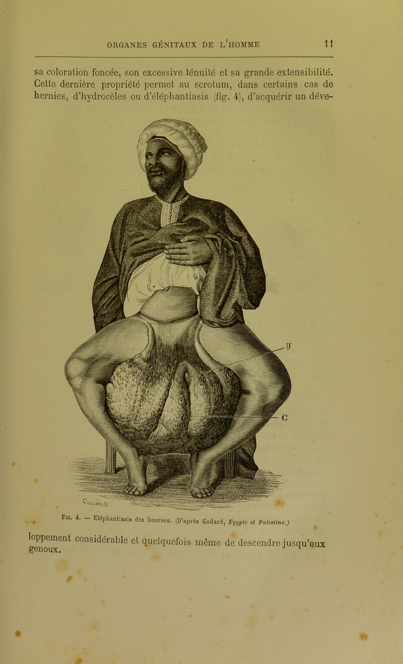 sa coloration foncée, son excessive ténuité et sa grande extensibilité. Cette dernière propriété permet au scrotum, dans certains cas de hernies, d’hydrocèles ou d’éléphantiasis (fig. 4), d’acquérir un déve- _ . Eléphantiasis des bourses. (D’après Godard, Egypte et Palestine.) loppement considérable et quelquefois même de descendre jusqu’aux genoux. ■' ^