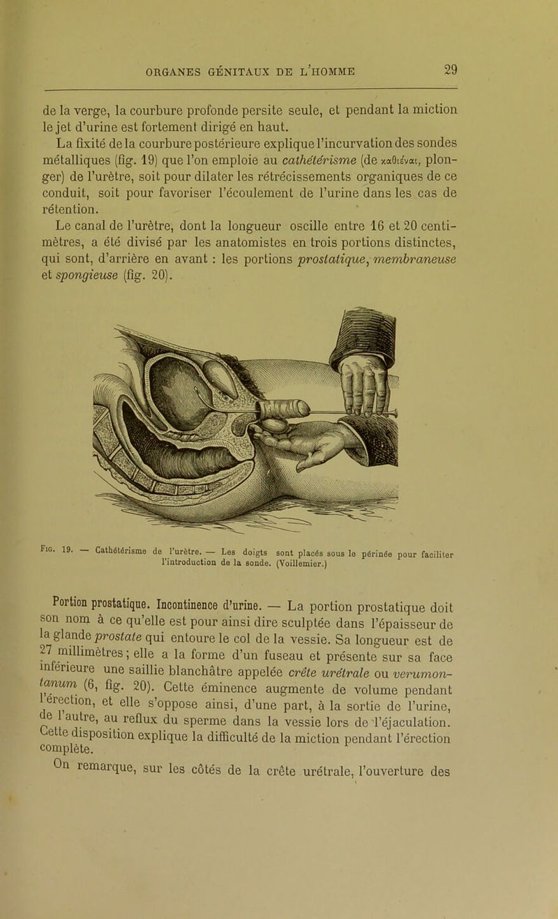 de la verge, la courbure profonde persite seule, et pendant la miction le jet d’urine est fortement dirigé en haut. La fixité de la courbure postérieure explique l’incurvation des sondes métalliques (fîg. 19) que l’on emploie au cathétérisme (de xaOtEvat, plon- ger) de l’urètre, soit pour dilater les rétrécissements organiques de ce conduit, soit pour favoriser l’écoulement de l’urine dans les cas de rétention. Le canal de l’urètre, dont la longueur oscille entre 16 et 20 centi- mètres, a été divisé par les anatomistes en trois portions distinctes, qui sont, d’arrière en avant ; les portions prostatique^ membraneuse tl spongieuse (fig. 20). Fio. 19. _ Cathétérisme de l’urètre. — Les doigts sont placés sous le périnée pour faciliter l'introduction de la sonde. (Voillemier.) Portion prostatique. Incontinence d’urine. — La portion prostatique doit son nom à ce qu’elle est pour ainsi dire sculptée dans l’épaisseur de la glande prosia^e qui entoure le col de la vessie. Sa longueur est de P millimètres ; elle a la forme d’un fuseau et présente sur sa face inférieure une saillie blanchâtre appelée crête urétrale ou verumon- tanum (6, fîg, 20). Cette éminence augmente de volume pendant érection, et elle s’oppose ainsi, d’une part, à la sortie de l’urine, e autre, au reflux du sperme dans la vessie lors de'l’éjaculation. ette disposition explique la difficulté de la miction pendant l’érection complète. On remarque, sur les côtés de la crête urétrale, l’ouverture des