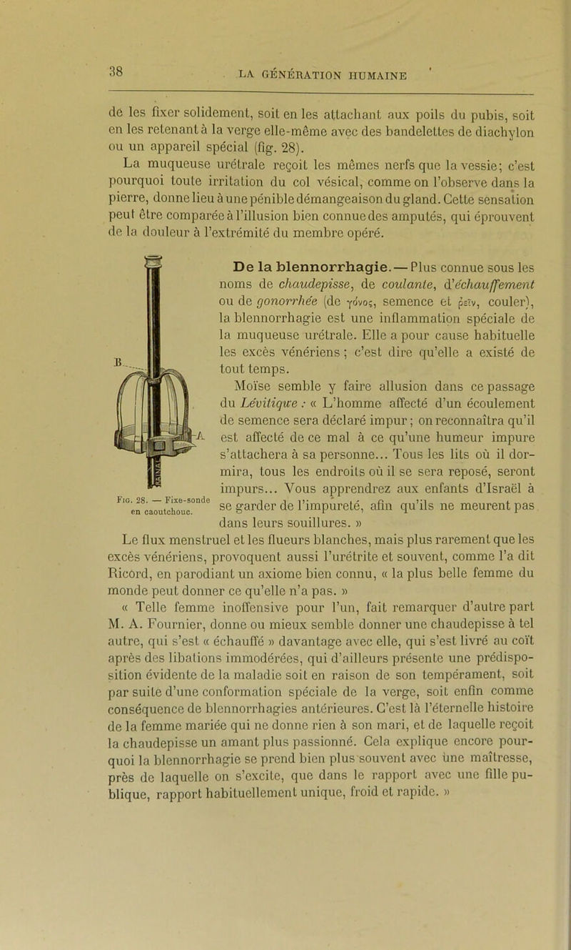 de les fixer solidement, soit en les attachant aux poils du pubis, soit en les retenant à la verge elle-même avec des bandelettes de diachylon ou un appareil spécial (fig. 28). La muqueuse urétrale reçoit les mêmes nerfs que la vessie; c’est pourquoi toute irritation du col vésical, comme on l’observe dans la pierre, donne lieu à une pénible démangeaison du gland. Cette sensation peut être comparée à l’illusion bien connuedes amputés, qui éprouvent de ta douleur à l’extrémité du membre opéré. De la blennorrhagie. — Plus connue sous les noms de chaudepisse, de coulante, d'e'chau/fement ou de gonorrhée (de yôvo;, semence et psîv, couler), la blennorrhagie est une inflammation spéciale de la muqueuse urétrale. Elle a pour cause habituelle les excès vénériens ; c’est dire qu’elle a existé de tout temps. Moïse semble y faire allusion dans ce passage du Lévitiqwe : « L’homme affecté d’un écoulement de semence sera déclaré impur; on reconnaîtra qu’il est affecté de ce mal à ce qu’une humeur impure s’attachera à sa personne... Tous les lits où il dor- mira, tous les endroits où il se sera reposé, seront impurs... Vous apprendrez aux enfants d’Israël à se garder de l’impureté, afin qu’ils ne meurent pas dans leurs souillures. » Le flux menstruel et les flueurs blanches, mais plus rarement que les excès vénériens, provoquent aussi l’urétrite et souvent, comme l’a dit Ricord, en parodiant un axiome bien connu, « la plus belle femme du monde peut donner ce qu’elle n’a pas. » « Telle femme inoffensive pour l’un, fait remarquer d’autre part M. A. Fournier, donne ou mieux semble donner une chaudepisse à tel autre, qui s’est « échauffé » davantage avec elle, qui s’est livré au coït après des libations immodérées, qui d’ailleurs présente une prédispo- sition évidente de la maladie soit en raison de son tempérament, soit par suite d’une conformation spéciale de la verge, soit enfin comme conséquence de blennorrhagies antérieures. C’est là l’éternelle histoire de la femme mariée qui ne donne rien à son mari, et de laquelle reçoit la chaudepisse un amant plus passionné. Cela explique encore pour- quoi la blennorrhagie se prend bien plus souvent avec une maîtresse, près de laquelle on s’excite, que dans le rapport avec une fille pu- blique, rapport habituellement unique, froid et rapide. «