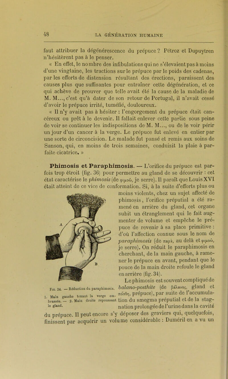 faut attribuer la dégénérescence du prépuce ? Pétroz et Dupuytren n’hésitèrent pas à le penser. « En effet, le nombre des infibulations qui ne s’élevaient pas à moins d’une vingtaine, les tractions sur le prépuce par le poids des cadenas, par les efforts de distension résultant des érections, paraissent des causes plus que suffisantes pour entraîner cette dégénération, et ce qui achève de prouver que telle avait été la cause de la maladie de M.M..., c’est qu’à dater de son retour de Portugal, il n’avait cessé d’avoir le prépuce irrité, tuméûé, douloureux. « Il n’y avait pas à hésiter : l’engorgement du prépuce était can- céreux ou prêt à le devenir. Il fallait enlever cette partie sous peine de voir se continuer les indispositions de M. M..., ou de le voir périr un jour d’un cancer à la verge. Le prépuce fut enlevé en entier par une sorte de circoncision. Le malade fut pansé et remis aux soins de Sanson, qui, en moins de trois semaines, conduisit la plaie à par- faite cicatrice. » Phimosis et Paraphimosis. — L’orifice du prépuce est par- fois trop étroit {fig. 36) pour permettre au gland de se découvrir ; cet état caractérise le phimosis (de je serre). Il paraît que Louis XVI était atteint de ce vice de conformation. Si, à la suite d’efforts plus ou moins violents, chez un sujet affecté de phimosis, l’orifice préputial a été ra- mené en arrière du gland, cet organe subit un étranglement qui le fait aug- menter de volume et empêche le pré- puce de revenir à sa place primitive : d’où l’affection connue sous le nom de paraphimosis (de wapi, au delà et çt[iotI), je serre). On réduit le paraphimosis en cherchant, de la main gauche, à rame- ner le prépuce en avant, pendant que le pouce de la main droite refoule le gland en arrière (fig. 34). Le phimosis est souvent compliqué de F,G. 34, Réduction du paraphimosis. bolanO-pOSthilC (de |3aXavOî, gland et ^ . , ridaOri, prépuce), par suite de l’accumula- brassée. — 2. Main droite repoussant tion du smegma preputial et de la stag- >0 nation prolongée de l’urine dans la cavité du prépuce. Il peut encore s’y déposer des graviers qui, quelquefois, finissent par acquérir un volume considérable : Duméril en a vu un