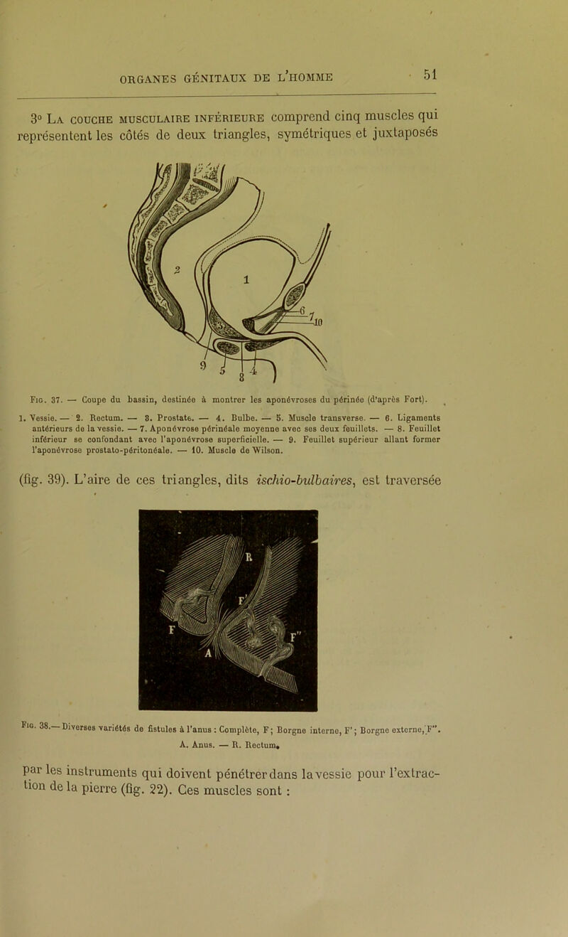 3“ La couche musculaire inférieure comprend cinq muscles qui représentent les côtés de deux triangles, symétriques et juxtaposés Fig. 37. — Coupe du bassin, destinée à montrer les aponévroses du périnée (d’après Fort). 1. Vessie.— î. Rectum. — 8. Prostate. — 4. Bulbe. — 5. Muscle transverse. — 6. Ligaments antérieurs de la vessie. — 7. Aponévrose périnéale moyenne avec ses deux feuillets. — 8. Feuillet inférieur se confondant avec l'aponévrose superficielle. — 9. Feuillet supérieur allant former l’aponévrose prostato-péritonéale. — 10. Muscle de Wilson. (fig. 39). L’aire de ces triangles, dits ischio-bulbaires^ est traversée Fio. 38, Diverses variétés do fistules à l'anus : Complète, F ; Borgne interne, F’ ; Borgne externe, F. A. Anus. — R. Rectum, par les instruments qui doivent pénétrer dans la vessie pour l’extrac- tion de la pierre (fig. 22). Ces muscles sont :