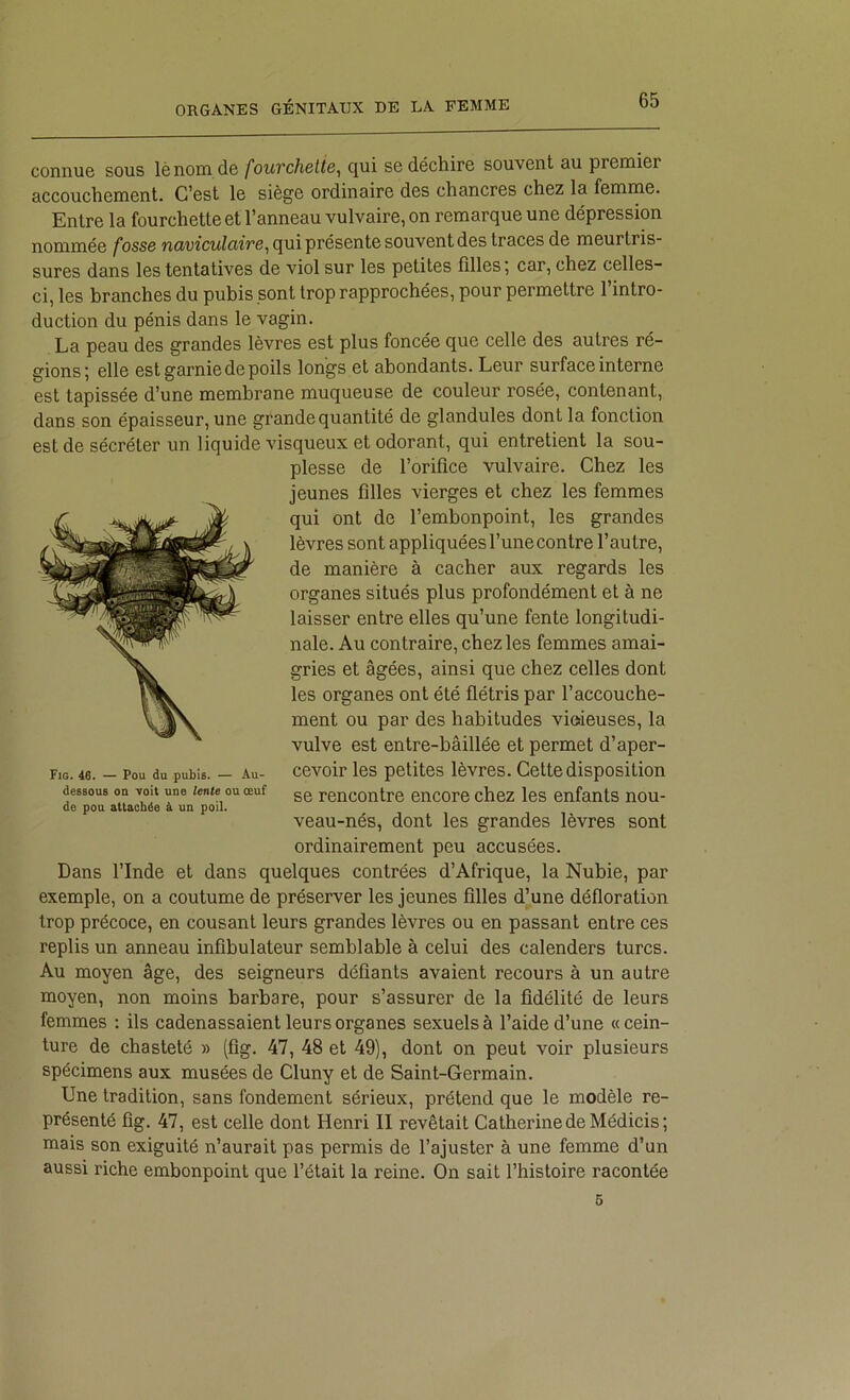 connue sous lènom de fouvchelie, qui se déchire souvent au premier accouchement. C’est le siège ordinaire des chancres chez la femme. Entre la fourchette et l’anneau vulvaire, on remarque une dépression nommée fosse wovîCMlflîVe, qui présente souvent des traces de meurtris- sures dans les tentatives de viol sur les petites filles; car, chez celles- ci, les branches du pubis sont trop rapprochées, pour permettre l’intro- duction du pénis dans le vagin. La peau des grandes lèvres est plus foncée que celle des autres ré- gions; elle est garnie de poils longs et abondants. Leur surface interne est tapissée d’une membrane muqueuse de couleur rosée, contenant, dans son épaisseur, une grande quantité de glandules dont la fonction est de sécréter un liquide visqueux et odorant, qui entretient la sou- plesse de l’orifice vulvaire. Chez les jeunes filles vierges et chez les femmes qui ont de l’embonpoint, les grandes lèvres sont appliquées l’une contre l’autre, de manière à cacher aux regards les organes situés plus profondément et à ne laisser entre elles qu’une fente longitudi- nale. Au contraire, chez les femmes amai- gries et âgées, ainsi que chez celles dont les organes ont été flétris par l’accouche- ment ou par des habitudes vioieuses, la vulve est entre-bâillée et permet d’aper- cevoir les petites lèvres. Cette disposition se rencontre encore chez les enfants nou- veau-nés, dont les grandes lèvres sont ordinairement peu accusées. Dans l’Inde et dans quelques contrées d’Afrique, la Nubie, par exemple, on a coutume de préserver les jeunes filles d^une défloration trop précoce, en cousant leurs grandes lèvres ou en passant entre ces replis un anneau infibulateur semblable à celui des calenders turcs. Au moyen âge, des seigneurs défiants avaient recours à un autre moyen, non moins barbare, pour s’assurer de la fidélité de leurs femmes ; ils cadenassaient leurs organes sexuels à l’aide d’une « cein- ture de chasteté » (fig. 47, 48 et 49), dont on peut voir plusieurs spécimens aux musées de Cluny et de Saint-Germain. Une tradition, sans fondement sérieux, prétend que le modèle re- présenté fig. 47, est celle dont Henri II revêtait Catherine de Médicis; mais son exiguité n’aurait pas permis de l’ajuster à une femme d’un aussi riche embonpoint que l’était la reine. On sait l’histoire racontée Fio. 46. — Pou du pubis. — Au- dessous on voit une lente ou œuf de pou attachée à un poil. 6