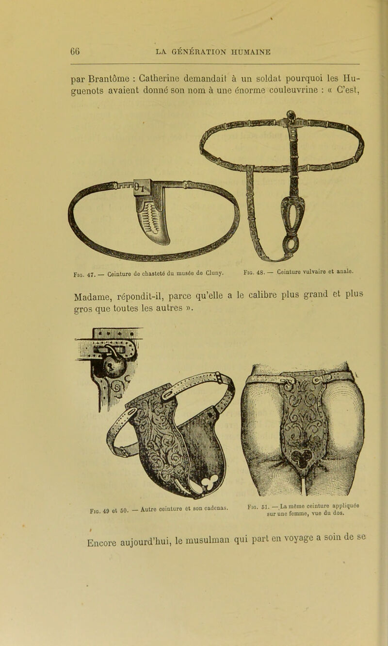 par Brantôme ; Catherine demandait à un soldat pourquoi les Hu- guenots avaient donné son nom à une énorme couleuvrine : a C’est, Pig. 47. Ceinture de chasteté du musée de Cluny. Fig. 48. — Ceinture vulvaire et anale. Madame, répondit-il, parce qu’elle a le calibre plus grand et plus gros que toutes les autres ». Fig. 51.—La même ceinture appliquée sur une femme, vue du dos. Fig. 43 et 60. — Autre ceinture et son cadenas. « Encore aujourd’hui, le musulman qui part en voyage a soin de se