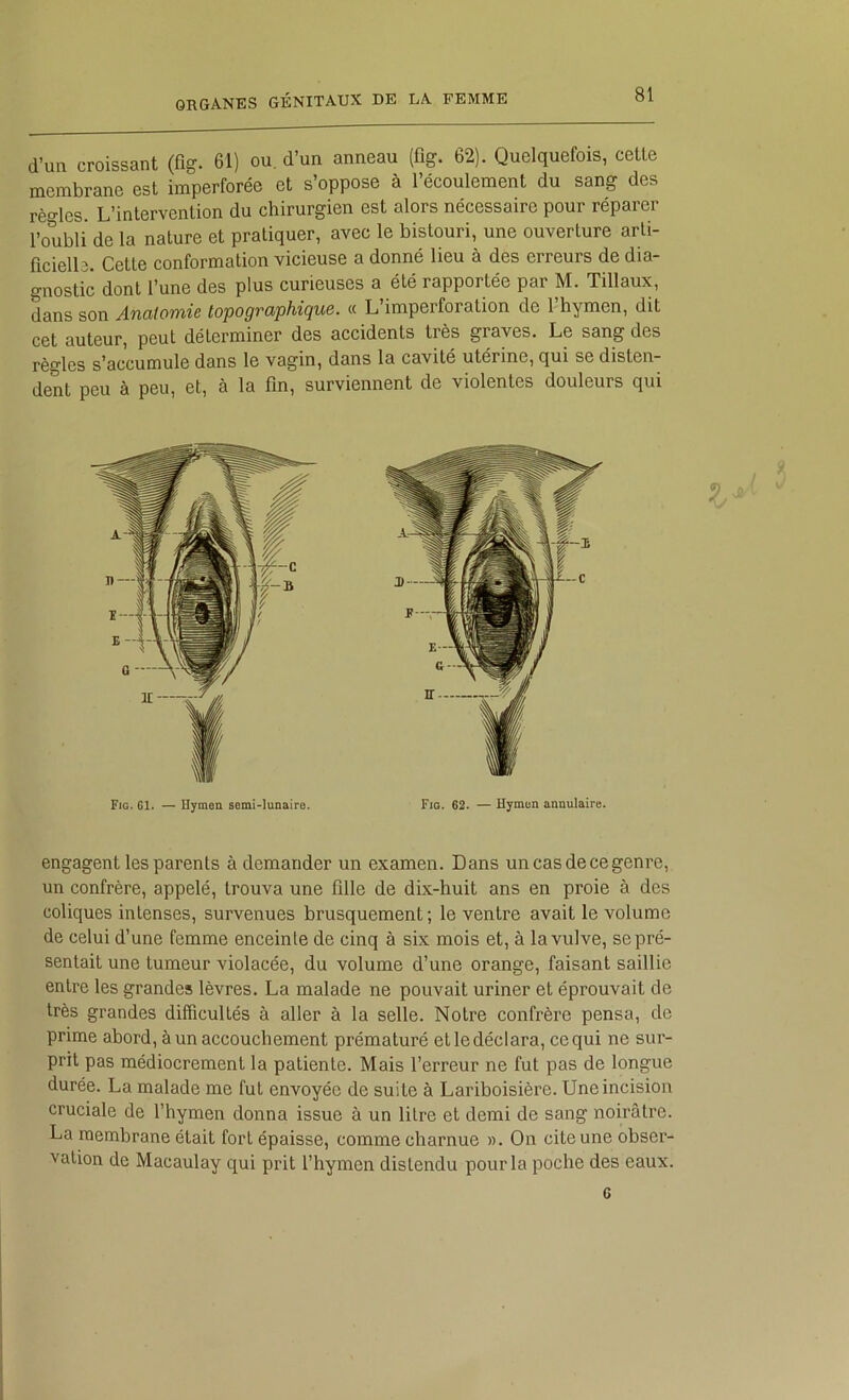 d’un croissant (fig. 61) ou. d’un anneau (flg. 62). Quelquefois, cette membrane est imperforée et s’oppose à l’écoulement du sang des règles. L’intervention du chirurgien est alors nécessaire pour réparer l’oubli de la nature et pratiquer, avec le bistouri, une ouverture arti- ficielle. Cette conformation vicieuse a donné lieu à des erreurs de dia- gnostic dont l’une des plus curieuses a été rapportée par M. Tillaux, dans son Anatomie topographique. « L imperforation de 1 hymen, dit cet auteur, peut déterminer des accidents très graves. Le sang des règles s’accumule dans le vagin, dans la cavité utérine, qui se disten- dent peu à peu, et, à la fin, surviennent de violentes douleurs qui engagent les parents à demander un examen. Dans un cas de ce genre, un confrère, appelé, trouva une fille de dix-huit ans en proie à des coliques intenses, survenues brusquement; le ventre avait le volume de celui d’une femme enceinte de cinq à six mois et, à la vulve, se pré- sentait une tumeur violacée, du volume d’une orange, faisant saillie entre les grandes lèvres. La malade ne pouvait uriner et éprouvait de très grandes difficultés à aller à la selle. Notre confrère pensa, de prime abord, à un accouchement prématuré et le déclara, ce qui ne sur- prit pas médiocrement la patiente. Mais l’erreur ne fut pas de longue durée. La malade me fut envoyée de suite à Lariboisière. Une incision cruciale de f hymen donna issue à un litre et demi de sang noirâtre. La membrane était fort épaisse, comme charnue ». On cite une obser- vation de Macaulay qui prit l’hymen distendu pour la poche des eaux. Fig. G1. — Hymen semi-lunaire. Fig. 62. — Hymen annulaire. C