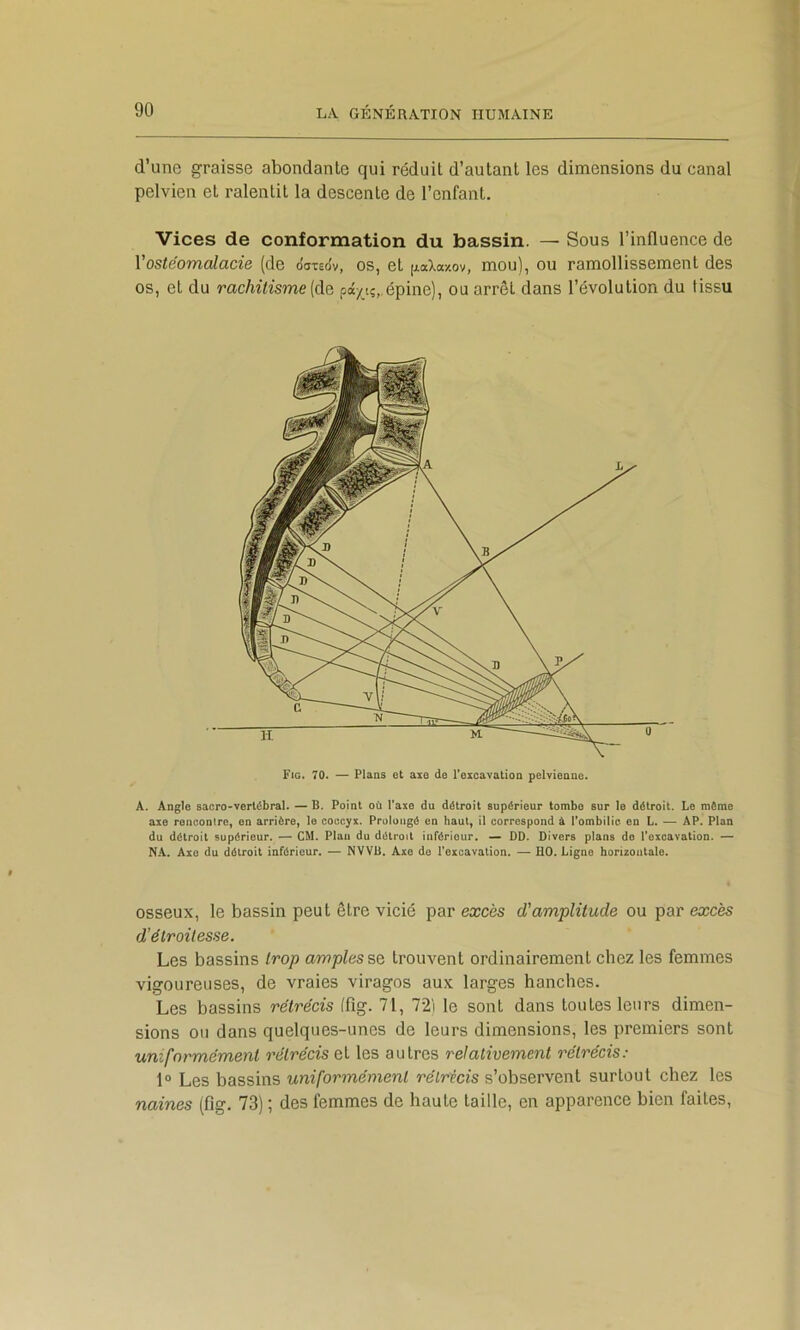 d’une graisse abondante qui réduit d’autant les dimensions du canal pelvien et ralentit la descente de l’enfant. Vices de conformation du bassin. — Sous l’influence de Vostéomalacie (de oct-ceov, os, et [xaXaxov, mou), ou ramollissement des os, et du rachitisme {de pâ/iç„épine), ou arrêt dans l’évolution du tissu A. Angle sacro-vertébral. — B, Point où Taxe du détroit supérieur tombe sur le détroit. Le môme axe ronconire, en arrière, le coccyx. Prolongé en haut, il correspond à l’ombilic en L, — AP. Plan du détroit supérieur. — CM. Plan du détroit inférieur. — DD. Divers plans de l’excavation. — NA. Axe du détroit inférieur. — NVVB. Axe do l’excavation. — HO. Ligne horizontale. osseux, le bassin peut être vicié par ecccès d'amplitude ou par excès d'étroitesse. Les bassins trop amples %e trouvent ordinairement chez les femmes vigoureuses, de vraies viragos aux larges hanches. Les bassins rétrécis ffig. 71, 72i le sont dans toutes leurs dimen- sions ou dans quelques-unes de leurs dimensions, les premiers sont uniformément rétrécis et les autres relativement rétrécis: 1° Les bassins uniformément rétrécis s’observent surtout chez les naines (fig. 73) ; des femmes de haute taille, en apparence bien faites.