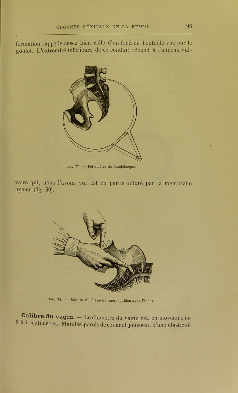 formation rappelle assez bien celle d’un fond de bouteille vue par le goulot. L’extrémité inférieure de ce conduit répond à l’anneau vul- Fig, 77. —Polvimôlre de Baudelocque. vaire qui, nous l’avons vu, est en partie obturé par la membrane hymen (fig. 60). Calibre du vagin. — Le diamètre du vagin est, en moyenne, de à 4 centimètres. Mais les parois de ce canal jouissent d’une élasticité