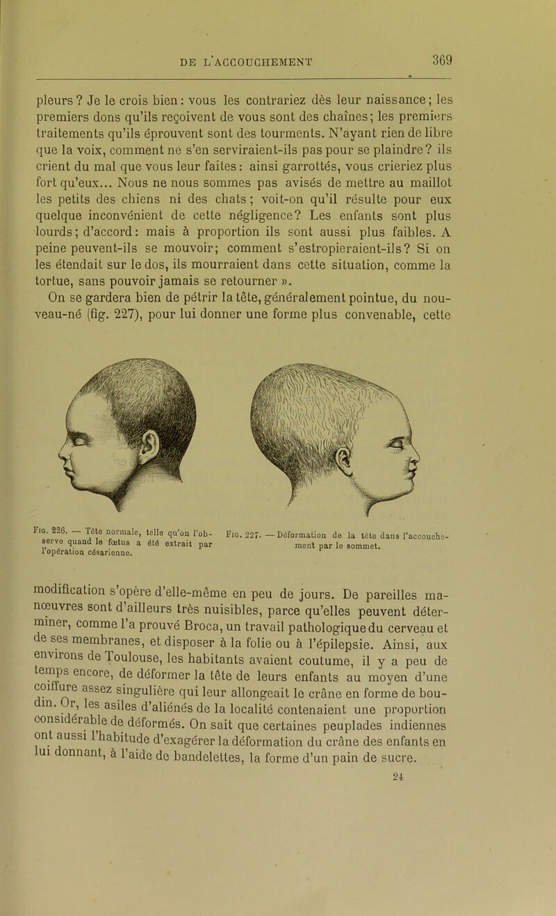 pleurs? Je le crois bien; vous les contrariez dès leur naissance; les premiers dons qu’ils reçoivent de vous sont des chaînes; les premiers traitements qu’ils éprouvent sont des tourments. N’ayant rien de libre que la voix, comment ne s’en serviraient-ils pas pour se plaindre? ils crient du mal que vous leur faites : ainsi garrottés, vous crieriez plus fort qu’eux... Nous ne nous sommes pas avisés de mettre au maillot tes petits des chiens ni des chats ; voit-on qu’il résulte pour eux quelque inconvénient de cette négligence? Les enfants sont plus lourds ; d’accord : mais à proportion ils sont aussi plus faibles. A peine peuvent-ils se mouvoir; comment s’estropieraient-ils? Si on les étendait sur le dos, ils mourraient dans cette situation, comme la tortue, sans pouvoir jamais se retourner ». On se gardera bien de pétrir la tête, généralement pointue, du nou- veau-né (fîg. 227), pour lui donner une forme plus convenable, cette Fig. 226. — T6le normale, telle qu’on l’ob- serve quand le fœtus a été extrait par l’opération césarienne. Fig. 227. — Déformation do la tête dans l’accouche- ment par le sommet. modification s opère d’elle-même en peu de jours. De pareilles ma- nœuvres sont d ailleurs très nuisibles, parce qu’elles peuvent déter- miner, comme 1 a prouvé Broca, un travail pathologique du cerveau et de ses membranes, et disposer à la folie ou à l’épilepsie. Ainsi, aux ent irons de Toulouse, les habitants avaient coutume, il y a peu de tei^s encore, de déformer la tête de leurs enfants au moyen d’une COI i^e assez singulière qui leur allongeait le crâne en forme de bou- in. r, les asiles d’aliénés de la localité contenaient une proportion consi érable de déformés. On sait que certaines peuplades indiennes ont aussi 1 habitude d’exagérer la déformation du crâne des enfants en ui donnant, à l’aide de bandelettes, la forme d’un pain de sucre. 2i