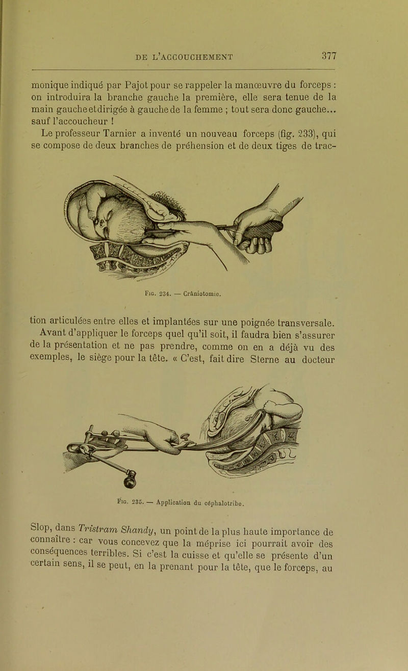 monique indiqué par Pajot pour se rappeler la manœuvre du forceps : on introduira la branche gauche la première, elle sera tenue de la main gauche et dirigée à gauche de la femme ; tout sera donc gauche... sauf l’accoucheur ! Le professeur Tarnier a inventé un nouveau forceps (fig. 233), qui se compose de deux branches de préhension et de deux tiges de trac- Fig. 234. — Crâniotomio. tion articulées entre elles et implantées sur une poignée transversale. Avant d’appliquer le forceps quel qu’il soit, il faudra bien s’assurer de la présentation et ne pas prendre, comme on en a déjà vu des exemples, le siège pour la tête. « C’est, fait dire Sterne au docteur Fig. 235. — Application du côphalotribo. op, dans Tristram Shandy, un point de la plus haute importance de connaître : car vous concevez que la méprise ici pourrait avoir des conséquences terribles. Si c’est la cuisse et qu’elle se présente d’un certain sens, il se peut, en la prenant pour la tête, que le forceps, au