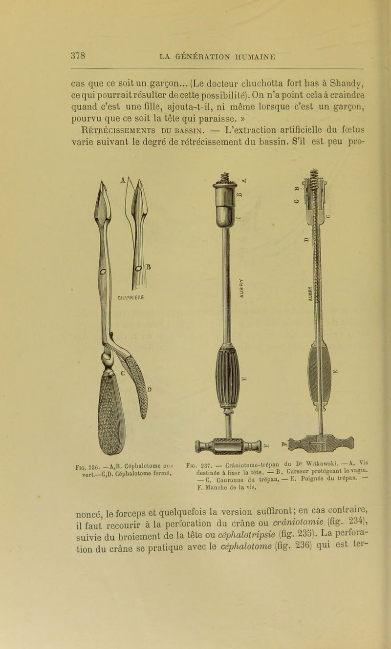 cas que ce soit un garçon... (Le docteur chuchotta fort bas à Shandy, ce qui pourrait résulter de cette possibilité). On n’a point cela à craindre quand c’est une fille, ajouta-t-il, ni même lorsque c’est un garçon, pourvu que ce soit la tête qui paraisse. » Rétrécissements du bassin. — L’extraction artificielle du fœtus varie suivant le degré de rétrécissement du bassin. S’il est peu pro- CHARRIERÊ Fio. 230. —A,B. Côphalotomo ou- vert.—C,D. Céphalotome fermé. Fio. 237. — Crâniolomo-trépan du D' Witkowski. —A. Vis destinée à fixer la tête. — B. Curseur protégeant le vagin. — C. Couronne du trépan. — E. Poignée du trépan. — F. Mancho de la vis. noncé, le forceps et quelquefois la version suffiront; en cas contraire, il faut recourir à la perforation du crâne ou craniotomie (fig. 234), suivie du broiement de la tête ou céphalolripsie (fig. 233). La perfora- tion du crâne se pratique avec le céphalotome (fig. 236) qui est ter-