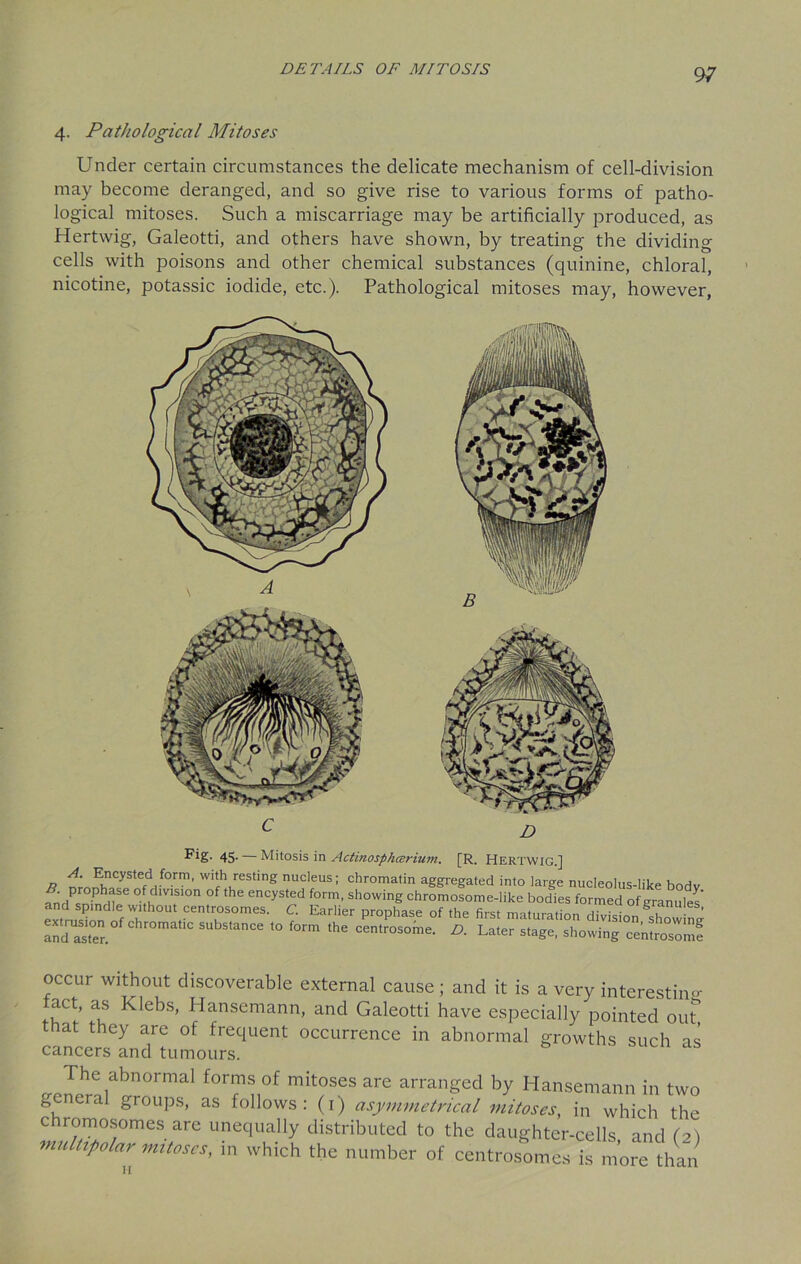 4. Pathological Mitoses Under certain circumstances the delicate mechanism of cell-division may become deranged, and so give rise to various forms of patho- logical mitoses. Such a miscarriage may be artificially produced, as Hertwig, Galeotti, and others have shown, by treating the dividing cells with poisons and other chemical substances (quinine, chloral, nicotine, potassic iodide, etc.). Pathological mitoses may, however, 45- — Mitosis in Actinosphcerium. [R. Hertwig.] n n‘ nl!lCyStefdrf0rrn’ witfh,resting nucleus; chromatin aggregated into large nucleolus-like body fn„P P , of,dlV1S,0n °f the enc>'sted showing chromosome-like bodies formed of granules’ and spindle without centrosomes. C. Earlier prophase of the first maturation division ^howinci andaster ^ silbs,ance “> ‘he centrosome. D. Later stage, showing centrosomf occur without discoverable external cause; and it is a very interesting tact, as Klebs, Hansemann, and Galeotti have especially pointed out that they are of frequent occurrence in abnormal growths such as cancers and tumours. b aS The abnormal forms of mitoses are arranged by Hansemann in two general groups, as follows: (1) asymmetrical mitoses, in which the chromosomes are unequally distributed to the daughter-cells, and (2) multipolar mitoses, in which the number of centrosomes is more than