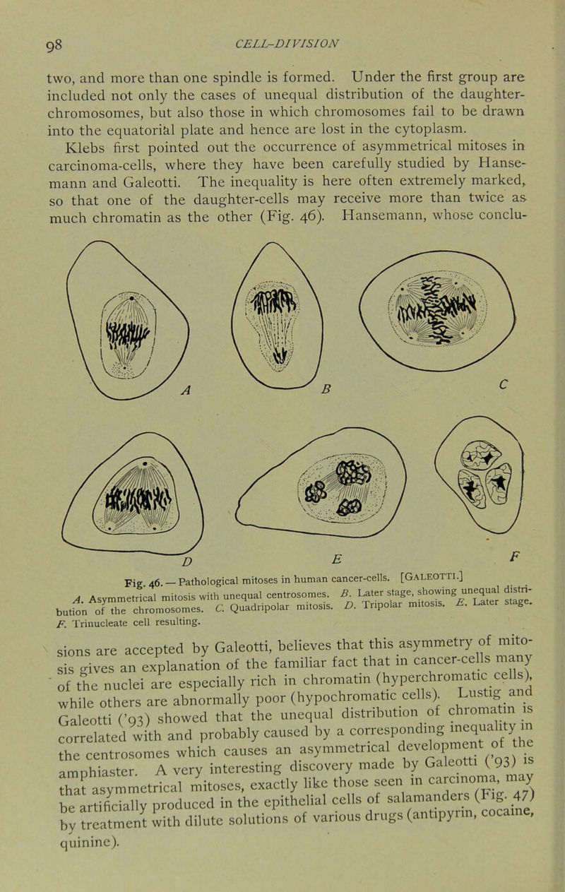 two, and more than one spindle is formed. Under the first group are included not only the cases of unequal distribution of the daughter- chromosomes, but also those in which chromosomes fail to be drawn into the equatorial plate and hence are lost in the cytoplasm. Klebs first pointed out the occurrence of asymmetrical mitoses in carcinoma-cells, where they have been carefully studied by Hanse- mann and Galeotti. The inequality is here often extremely marked, so that one of the daughter-cells may receive more than twice as- much chromatin as the other (Fig. 46). Hansemann, whose conclu- Fig 46 — Pathological mitoses in human cancer-cells. [GALEOTTI.] A. Asymmetrical mitosis with unequal eenttosomes. B. latter slag.: J^ng unequal d«t„- bulion of the chromosomes. C. Quadripolar mttosts. D. Tr.polar mitosts. E. Later stage. F. Trinucleate cell resulting. sions are accepted by Galeotti, believes that this asymmetry of mito- sis rives an explanation of the familiar fact that in cancer-cells many of the nuclei are especially rich in chromatin (hyperchromatici cells), while others are abnormally poor (hypochromatic cel s). - • & Galeotti (’93) showed that the unequal distribution of chromatin is correlated with and probably caused by a corresponding mequahty m the centrosomes which causes an asymmetrical development of t amnhiaster A very interesting discovery made by Galeotti ( 93) that asymmetrical mitoses, exactly like those seen in carcinoma, may be artificially produced in the epithelial cells of by treatment with dilute solutions of various drugs (antipyrin, cocai , quinine).