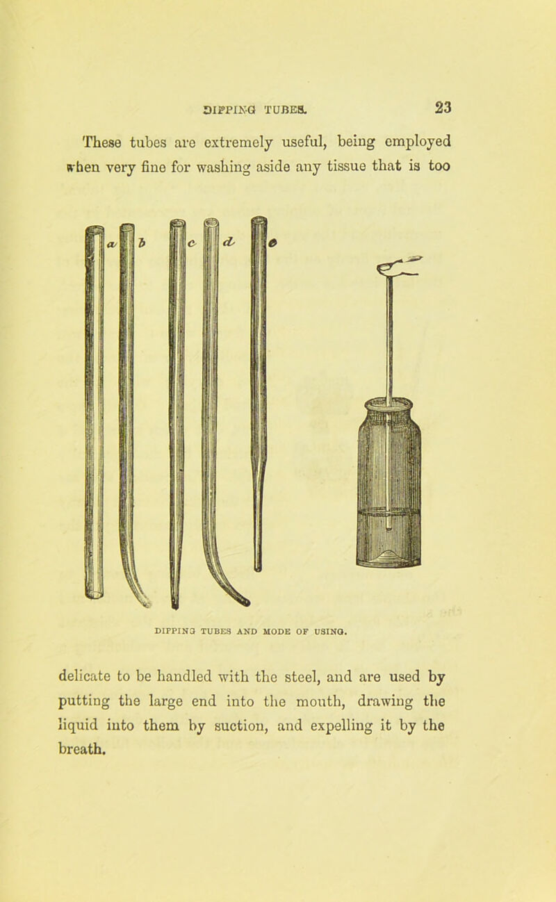 These tubes are extremely useful, being employed svhen very fine for washing aside any tissue that is too DIPPING TUBES AND MODE OF USING. delicate to be handled with the steel, and are used by putting the large end into the mouth, drawing the liquid into them by suction, and expelling it by the breath.