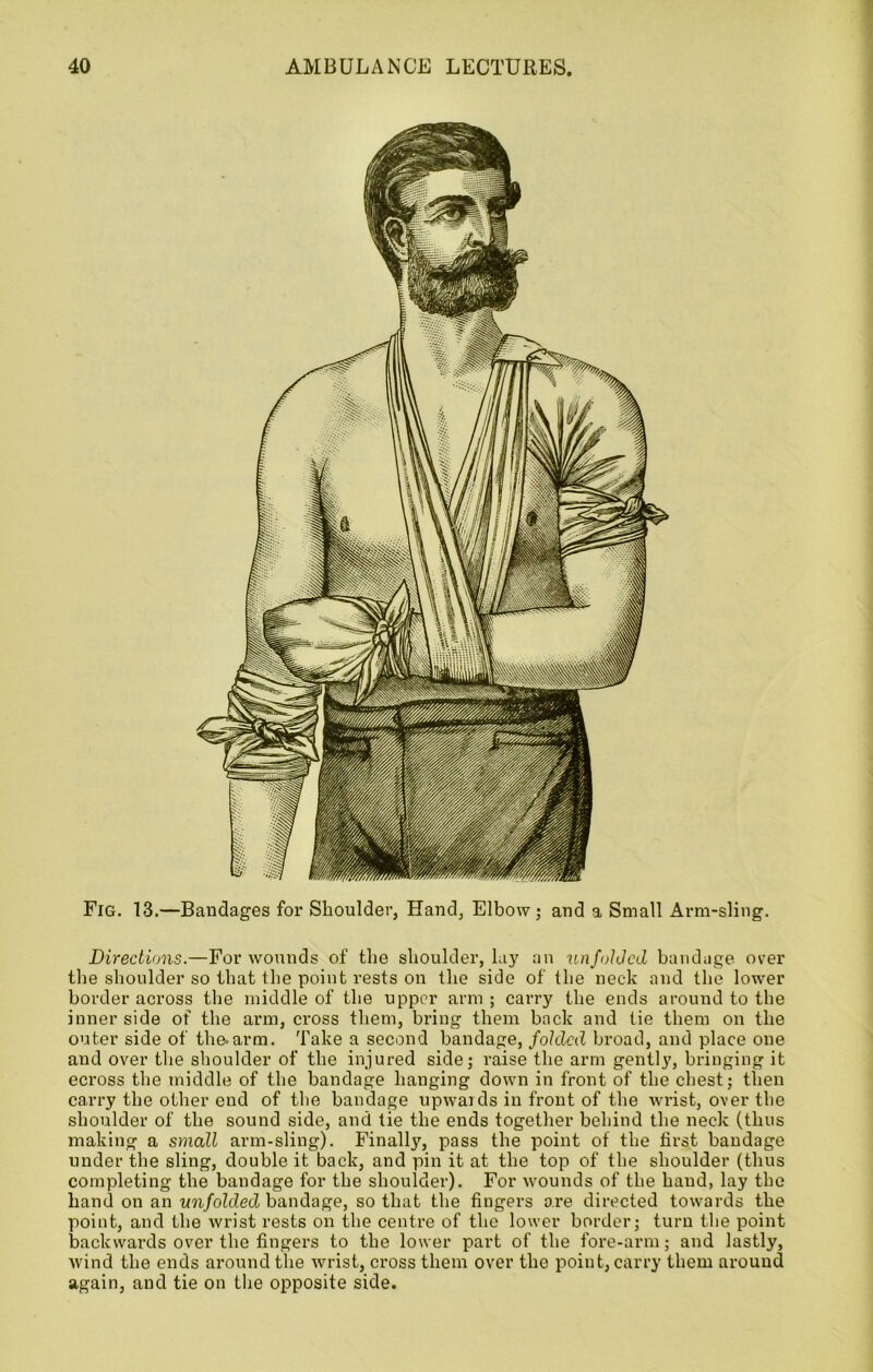 Fig. 13.—Bandages for Shoulder, Hand, Elbow; and a Small Arm-sling. Directions.—For wounds of the shoulder, lay an unfolded bandage over the shoulder so that the point rests on the side of the neck and the lower border across the middle of the upper arm; carry the ends around to the inner side of the arm, cross them, bring them back and tie them on the outer side of the.arm. Take a second bandage, folded broad, and place one and over the shoulder of the injured side; raise the arm gently, bringing it eci’oss the middle of the bandage hanging down in front of the chest; then carry the other end of the bandage upwards in front of the wrist, over the shoulder of the sound side, and tie the ends together behind the neck (thus making a small arm-sling). Finalty, pass the point of the first bandage under the sling, double it back, and pin it at the top of the shoulder (thus completing the bandage for the shoulder). For wounds of the hand, lay the hand on an unfolded bandage, so that the fingers are directed towards the point, and the wrist rests on the centre of the lower border; turn the point backwards over the fingers to the lower part of the fore-arm; and lastly, wind the ends around the wrist, cross them over the point, carry them around again, and tie on the opposite side.