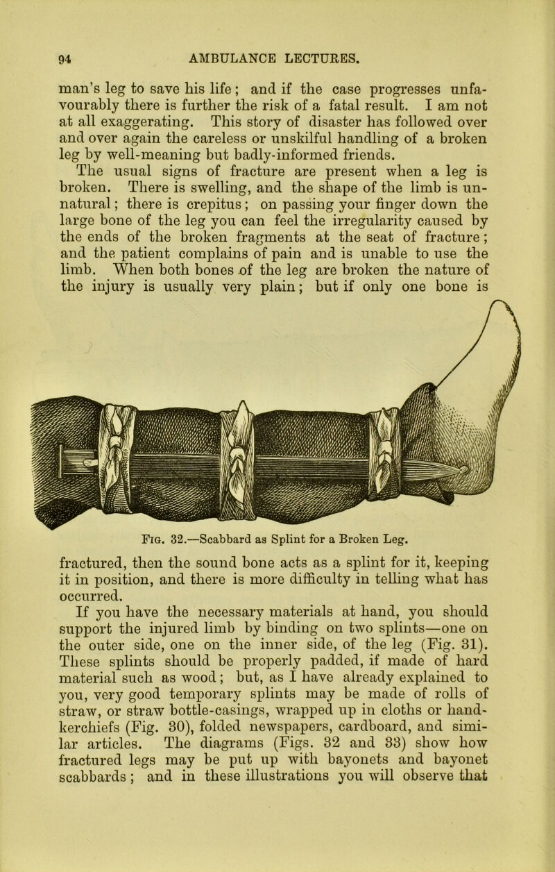 man’s leg to save his life; and if the case progresses unfa- vourably there is further the risk of a fatal result. I am not at all exaggerating. This story of disaster has followed over and over again the careless or unskilful handling of a broken leg by well-meaning but badly-informed friends. The usual signs of fracture are present when a leg is broken. There is swelling, and the shape of the limb is un- natural ; there is crepitus; on passing your finger down the large bone of the leg you can feel the irregularity caused by the ends of the broken fragments at the seat of fracture; and the patient complains of pain and is unable to use the limb. When both bones nf the leg are broken the nature of the injury is usually very plain; but if only one bone is fractured, then the sound bone acts as a splint for it, keeping it in position, and there is more difficulty in telling what has occurred. If you have the necessary materials at hand, you should support the injured limb by binding on two splints—one on the outer side, one on the inner side, of the leg (Fig. 31). These splints should be properly padded, if made of hard material such as wood; but, as I have already explained to you, very good tem^Dorary splints may be made of rolls of straw, or straw bottle-casings, wrapped up in cloths or hand- kerchiefs (Fig. 30), folded newspapers, cardboard, and simi- lar articles. The diagrams (Figs. 32 and 33) show how fractured legs may be put up with bayonets and bayonet scabbards ; and in these illustrations you will observe that Fig. 32.—Scabbard as Splint for a Broken Leg.