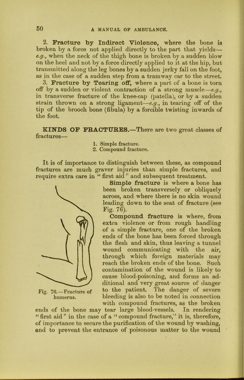 2. Fracture by Indirect Violence, where the bone is broken by a force not applied directly to the part that yields— e.g.^ when the neck of the thigh bone is broken by a sudden blow on the heel and not by a force directly applied to it at the hip, but transmitted along the leg bones by a sudden jerky fall on the foot, as in the case of a sudden step from a tramway car to the street. 3. Fracture by Tearing off, where a part of a bone is torn off by a sudden or violent contraction of a strong muscle—e.g., in transverse fracture of the knee-cap (patella), or by a sudden strain thrown on a strong ligament—e.g.^ in tearing off of the tip of the brooch bone (fibula) by a forcible twisting inwards of the foot. KINDS OF FRACTURES.—There are two great classes of fractures— 1. Simple fracture. 2. Compound fracture. It is of importance to distinguish between these, as compound fractures are much graver injuries than simple fractures, and require extra care in “ first aid ” and subsequent treatment. Simple fracture is where a bone has been broken transversely or obliquely across, and where there is no skin wound leading down to the seat of fracture (see Fig. 76). Compound fracture is where, from extra violence or from rough handling of a simple fracture, one of the broken ends of the bone has been forced through the flesh and skin, thus leaving a tunnel wound communicating with the air, through which foreign materials may reach the broken ends of the bone. Such contamination of the wound is likely to cause blood-poisoning, and forms an ad- ditional and very great source of danger to the patient. The Fig. 76.—Fracture of humerus. danger of severe bleeding is also to be noted in connection with compound fractures, as the broken ends of the bone may tear large blood-vessels. In rendering “first aid” in the case of a “ compound fracture,” it is, therefore, of importance to secure the purification of the wound by washing, and to prevent the entrance of poisonous matter to the wound