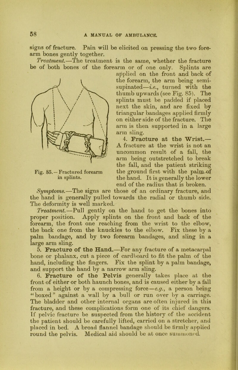 signs of fracture. Pain will be elicited on pressing the two fore- arm bones gently together. Treatment.—The treatment is the same, whether the fracture be of both bones of the forearm or of one only. Splints are applied on the front and back of the forearm, the arm being semi- supinated—i.e., turned with the thumb upwards (see Fig. 85). The splints must be padded if placed next the skin, and are fixed by triangular bandages applied firmly on either side of the fracture. The arm is then supported in a large arm sling. 4. Fracture at the Wrist.— A fracture at the wrist is not an uncommon result of a fall, the arm being outstretched to break the fall, and the patient striking the ground first with the palm-of the hand. It is generally the lower end of the radius that is broken. Symptoms.—The signs are those of an ordinary fracture, and the hand is generally pulled towards the radial or thumb side. The deformity is well marked. Treatment.—Pull gently on the hand to get the bones into proper position. Apply splints on the front and back of the forearm, the front one reaching from the wrist to the elbow, the back one from the knuckles to the elbow. Fix these by a palm bandage, and by two forearm bandages, and sling in a large arm sling. 5. Fracture of the Hand.—For any fracture of a metacarpal bone or phalanx, cut a piece of cardboard to fit the palm of the hand, including the fingers. Fix the splint by a palm bandage, and support the hand by a narrow arm sling. 6. Fracture of the Pelvis generally takes place at the front of either or both haunch bones, and is caused either by a fall from a height or by a compressing force—e.g., a person being “boxed” against a wall by a bull or run over by a carriage. The bladder and other internal organs are often injured in this fracture, and these complications form one of its chief dangers. If pelvic fracture be suspected from the history of the accident the patient should be carefully lifted, carried on a stretcher, and placed in bed. A broad flannel bandage should be firmly applied round the pelvis. Medical aid should be at once suiuinoncd. Fig. 85. —Fractured forearm in splints.