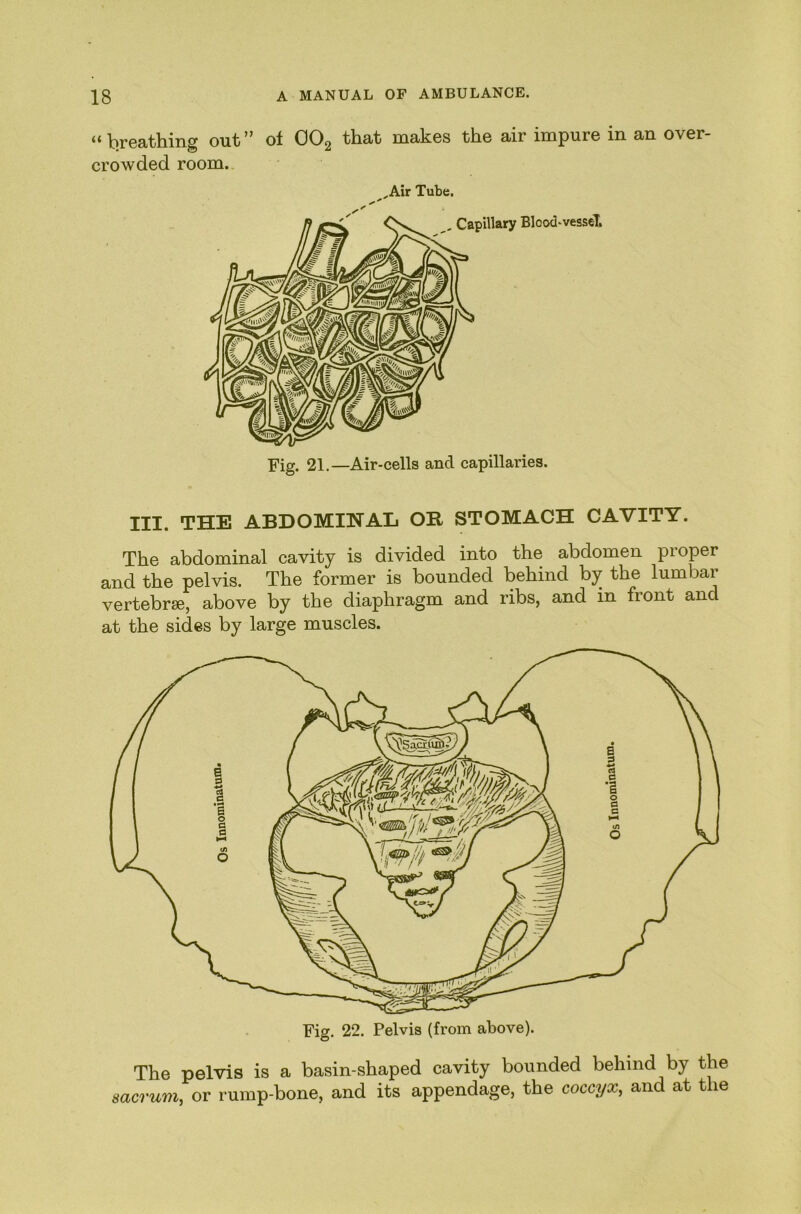 “breathing out” oi OOg that makes the air impure in an over- crowded room. Air Tube. , Capillary Blood'vessel, Fig. 21.—Air-cells and capillaries. III. THE ABDOMINAL OB STOMACH CAVITY. The abdominal cavity is divided into the abdomen pioper and the pelvis. The former is bounded behind by the lumbar vertebrae, above by the diaphragm and ribs, and in front and at the sides by large muscles. The pelvis is a basin-shaped cavity bounded behind by the sacrum, or rump-bone, and its appendage, the coccyx, and at the