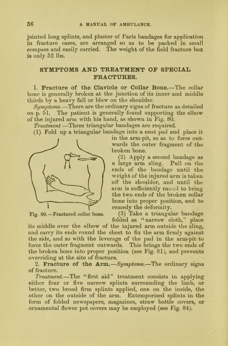 jointed long splints, and plaster of Paris bandages for application in fracture cases, are arranged so as to be packed in small compass and easily carried. The weight of the field fracture box is only 52 lbs. SYMPTOMS AND TREATMENT OF SPECIAL FRACTURES. 1. Fracture of the Clavicle or Collar Bone.—The collar bone is generally broken at the junction of its inner and middle thirds by a heavy fall or blow on the shoulder. Sym'ptoms.—There are the ordinary signs of fracture as detailed on p. 51. The patient is generally found supporting the elbow of the injured arm with his hand, as shown in Fig. 80. Treatment —Three triangular bandages are required. (1) Fold up a triangular bandage into a neat pad and place it in the arm-pit, so as to force out- wards the outer fragment of the broken bone. (2) Apply a second bandage as a large arm sling. Pull on the ends of the bandage until the weight of the injured arm is taken off the shoulder, and until the arm is sufficiently rained to bring the two ends of the broken collar bone into proper position, and to remedy the deformity. (3) Take a triangular bandage folded as “narrow cloth,’’ place its middle over the elbow of the injured arm outside the sling, and carry its ends round the chest to fix the arm firmly against the side, and so with the leverage of the pad in the arm-pit to force the outer fragment outwards. This brings the two ends of the broken bone into proper position (see Fig. 81), and prevents overriding at the site of fracture. 2. Fracture of the Arm.—Symptoms.—The ordinary signs of fracture. Treatment.—The “ first aid ” treatment consists in applying either four or five narrow splints surrounding the limb, or better, two broad firm splints applied, one on the inside, the other on the outside of the arm. Extemporised sphnts in the form of folded newspapers, magazines, straw bottle covers, or ornamental flower pot covers may be employed (see Fig. 84). Fig. 80.—Fractured collar bone.