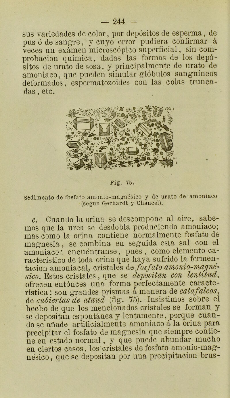 sus variedades de color, por depôsitos de esperaia, de pus 6 de saugre, y cuyo error pudiera confirmar à veces un exâmeu microscôpico superficial, sin com- probacion quimica, dadas las formas de los depô- sitos de urato desosa, y principalmeute de urato de amouiaco, que puedeii simular glôbulos sangumeos deformados, espermatozoides cou las colas trunca- das, etc. Fig. 75. Sisdimeato de fosfato amonio-raagnésico y de urato de anioniaco (segun Gerhardt y Ghancel). c. Cuaudo la orina se descompoue al aire, sabe- inos que la urea se desdobla produciendo amouiaco; mas como la oriua coutieue normalmente fosfato de maguesia, se combiua eu seguida esta sal cou el amouiaco *. eucuéutrause, pues , como elemeuto ca- racteristico de toda oriua que baya sufrido la fermen- tacion amouiacal, cristales fosfato amonio-magné- sico. Estos cristales, que se clepositan con lentiUtd, ofreceu eutôuces uua forma perfectameute caracte- ristica: sou graudes prismas a mauera de catafalcos, &Q cubiertas de ataiod (âg. 75). lusistimos sobre el hecbo de que los meuciouados cristales se forman y se depositau espoutâueay leutameute, porque cuan- do se anade artificialmeute amouiaco â la oriua para précipitai’ el fosfato de maguesia que siempre contie- ne eu estado normal, y que puede abuudar^ mucbo en ciertos casos, los cristales de fosfato amouio-mag- nésico, que se depositau por uua precipitaciou brus-